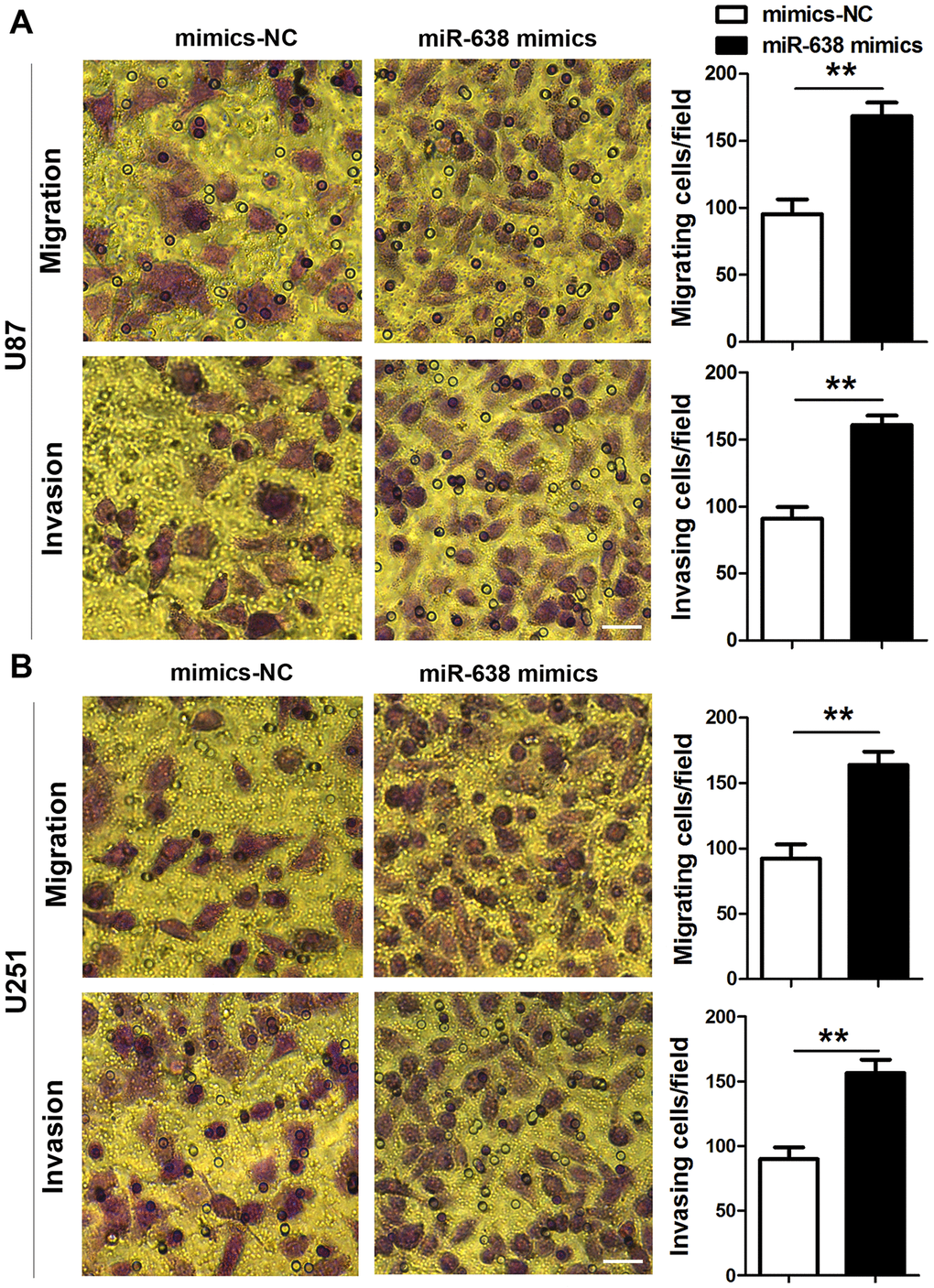 Overexpression of miR-638 promotes glioma cell migration and invasion. (A, B) U87 and U251 glioma cells were transfected with miR-638 mimics, and both cells migration and invasion were determined using transwell assays. Results represent the mean±SD for three independent experiments (**pt-test). Scale bar = 50 μm in all panels.