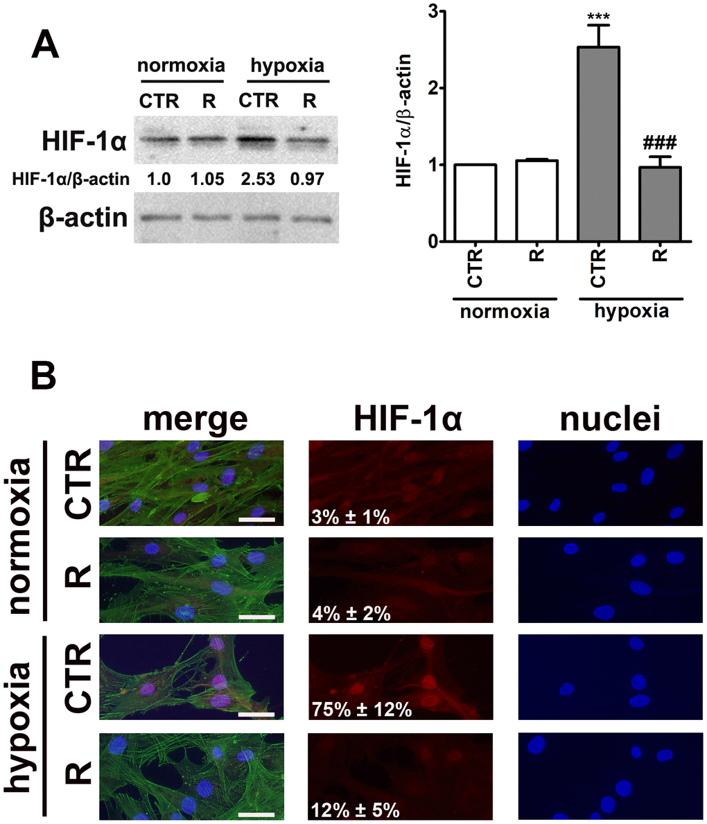 HIF-1α upregulation (A) and nuclear translocation (B) upon stimulation with hypoxia-mimetic agent cobalt chloride and the effect of remifentanil preconditioning in HCM cells. (A) Western blot analysis of the levels of HIF-1α. Data were normalized to β-actin. (B) Immunofluorescence analysis of cellular localization of HIF-1α (red). Representative microphotographs are shown, objective 10×, scale bars 10 μm. F-actin staining (green) and nucleus staining (blue) were also considered. Nuclear immuno-signals of HIF-1α were calculated [%]. Bars indicate SD, n = 3, ***p ###p a posteriori test). CTR, control; R, remifentanil preconditioning.