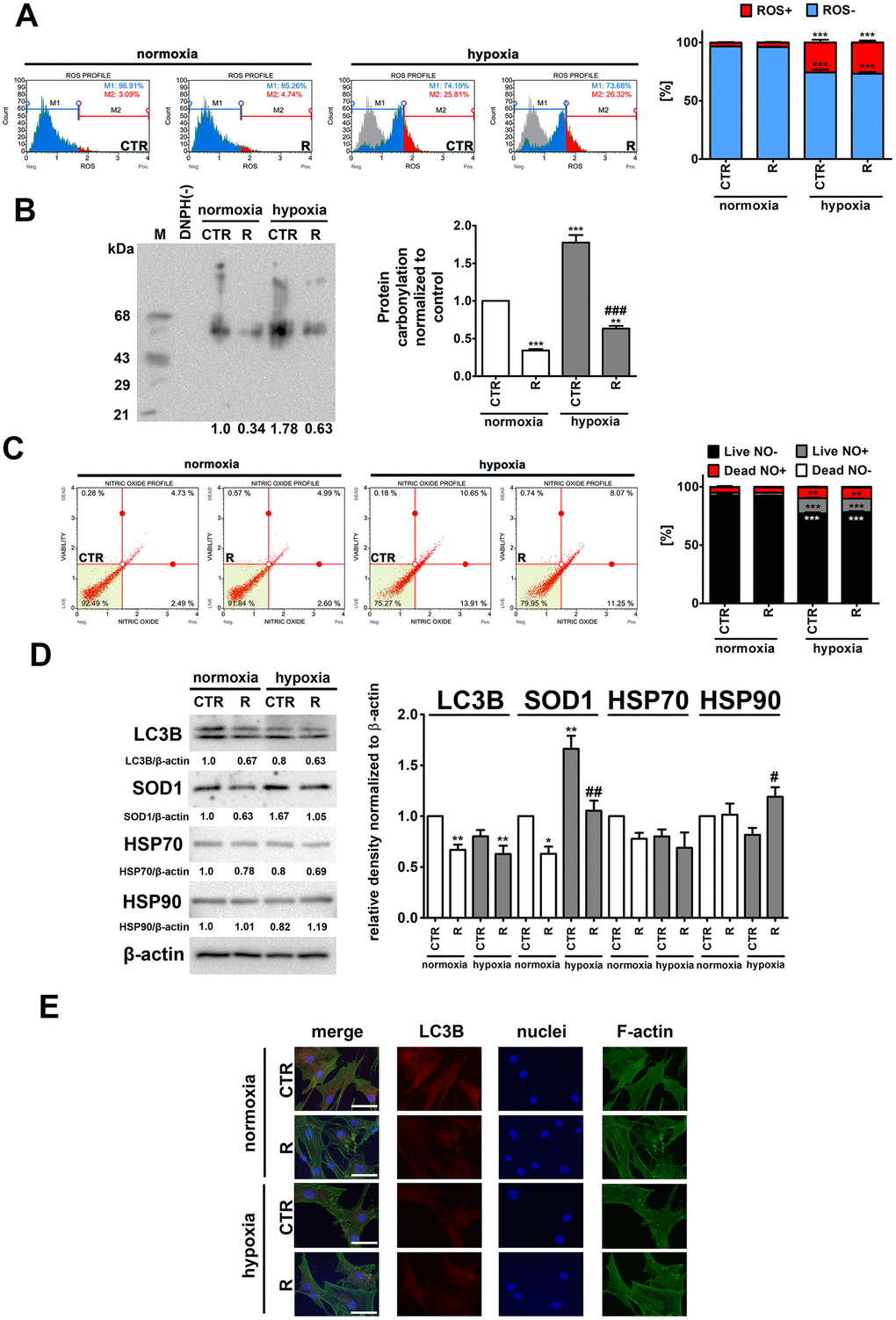 Hypoxia-induced oxidative stress (A, B), nitrosative stress (C), adaptive oxidative stress, heat shock/chaperone and autophagy-based responses (D, E), and the effect of remifentanil preconditioning in HCM cells. (A) Superoxide levels were measured using Muse® Cell Analyzer and Muse® Oxidative Stress Kit. Representative histograms are presented. (B) Protein carbonylation was investigated using OxyBlot™ Protein Oxidation Detection Kit. A negative control without DNPH derivatization (lane DNPH(-)) and a positive control with a mixture of standard proteins with attached DNP residues (lane M) are also shown. The levels of oxidative protein damage were normalized and protein carbonylation during normoxic control conditions was considered as 1. (C) Nitric oxide levels were investigated using Muse® Cell Analyzer and Muse® Nitric Oxide Kit. Representative dot-plots are also shown. (D) Western blot analysis of the levels of LC3B, SOD1, HSP70 and HSP90. Data were normalized to β-actin. (E) Immunofluorescence analysis of cellular localization of LC3B (red). Representative microphotographs are shown, objective 10×, scale bars 15 μm. F-actin staining (green) and nucleus staining (blue) were also considered. Bars indicate SD, n = 3, ***p **p *p ###p ##p #p a posteriori test). CTR, control; R, remifentanil preconditioning.