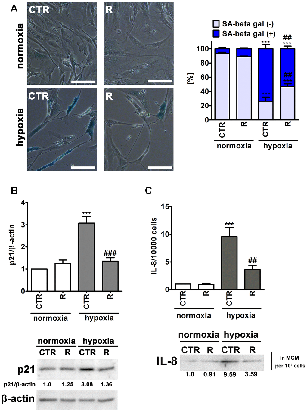 Remifentanil preconditioning protects against hypoxia-induced senescence in HCM cells. (A) Senescence-associated β-galactosidase (SA-β-gal) activity. Representative microphotographs are shown. Scale bars 50 μm, objective 20×. The levels of SA-β-gal positive (blue) and negative (no blue) cells were calculated [%]. (B) Western blot analysis of the levels of cell cycle inhibitor p21. Data were normalized to β-actin. (C) Western blot analysis of the levels of pro-inflammatory cytokine IL-8. IL-8 levels in supernatants (Myocyte Growth Medium, MGM) were calculated per 10000 cells. Bars indicate SD, n = 3, ***p ###p ##p a posteriori test). CTR, control; R, remifentanil preconditioning.