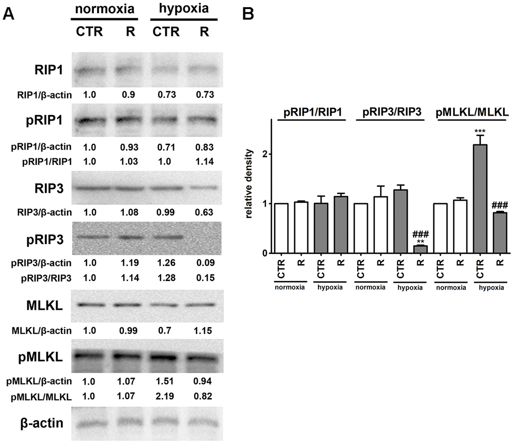 Remifentanil preconditioning protects against hypoxia-induced necroptosis in HCM cells. (A, B) Western blot analysis of the levels of RIP1, phospho-RIP1, RIP3, phospho-RIP3, MLKL and phospho-MLKL. Data were normalized to β-actin. The levels of phospho-RIP1, phospho-RIP3 and phospho-MLKL are also presented as a ratio of phospho-RIP1 to RIP1, phospho-RIP3 to RIP3 and phospho-MLKL to MLKL, respectively. (B) Bars indicate SD, n = 3, ***p **p ###p a posteriori test). CTR, control; R, remifentanil preconditioning.
