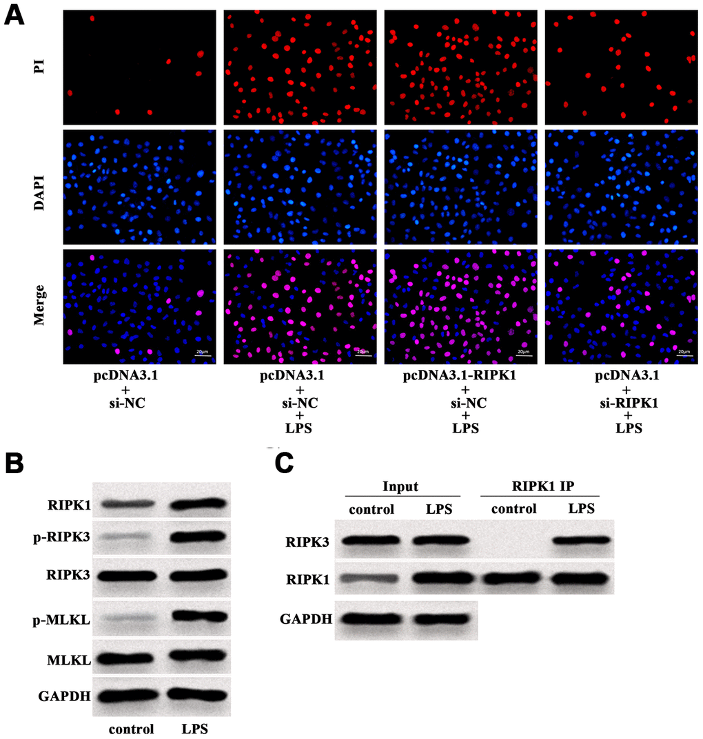 LPS induced RIPK1-mediated necroptosis of Caco-2 cells. (A) PI positive staining of LPS-treated Caco-2 cells with pcDNA3.1-RIPK1 transfection or RIPK1 siRNA transfection. (B) The protein level of RIPK1, p-RIPK3, RIPK3, p-MLKL and MLKL in LPS-treated Caco-2 cells. (C) IP assay was conducted to determine the interaction between RIPK1 and RIPK3 in LPS-treated Caco-2 cells. Scale bar = 20 μm.