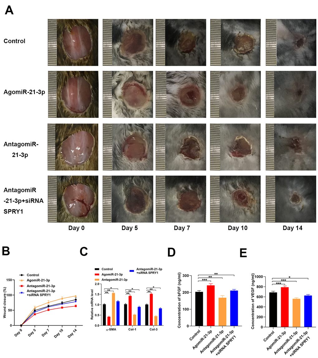 MiR-21-3p accelerates wound healing in vivo. (A) General view of the wound healing process in the mice that received different treatments (n=10, per group); (B) The closure rate of the wound in the mice that received different treatments; (C) The levels of α-SMA, Col 1, and Col 3 mRNA in the tissues from mice in the different treatment groups were measured by qRT-PCR (D, E) The concentrations of bFGF and VEGF in the tissues from the different treatment groups were determined by ELISA. Data are presented as the mean ± SD from three independent experiments. *p 