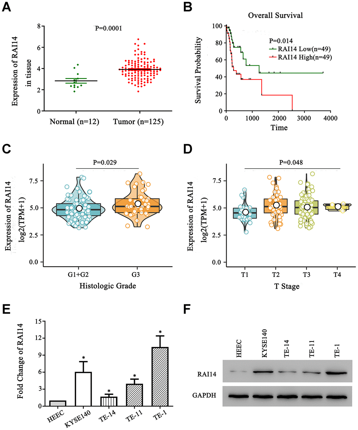 RAI14 silencing suppresses progression of esophageal cancer via the ...