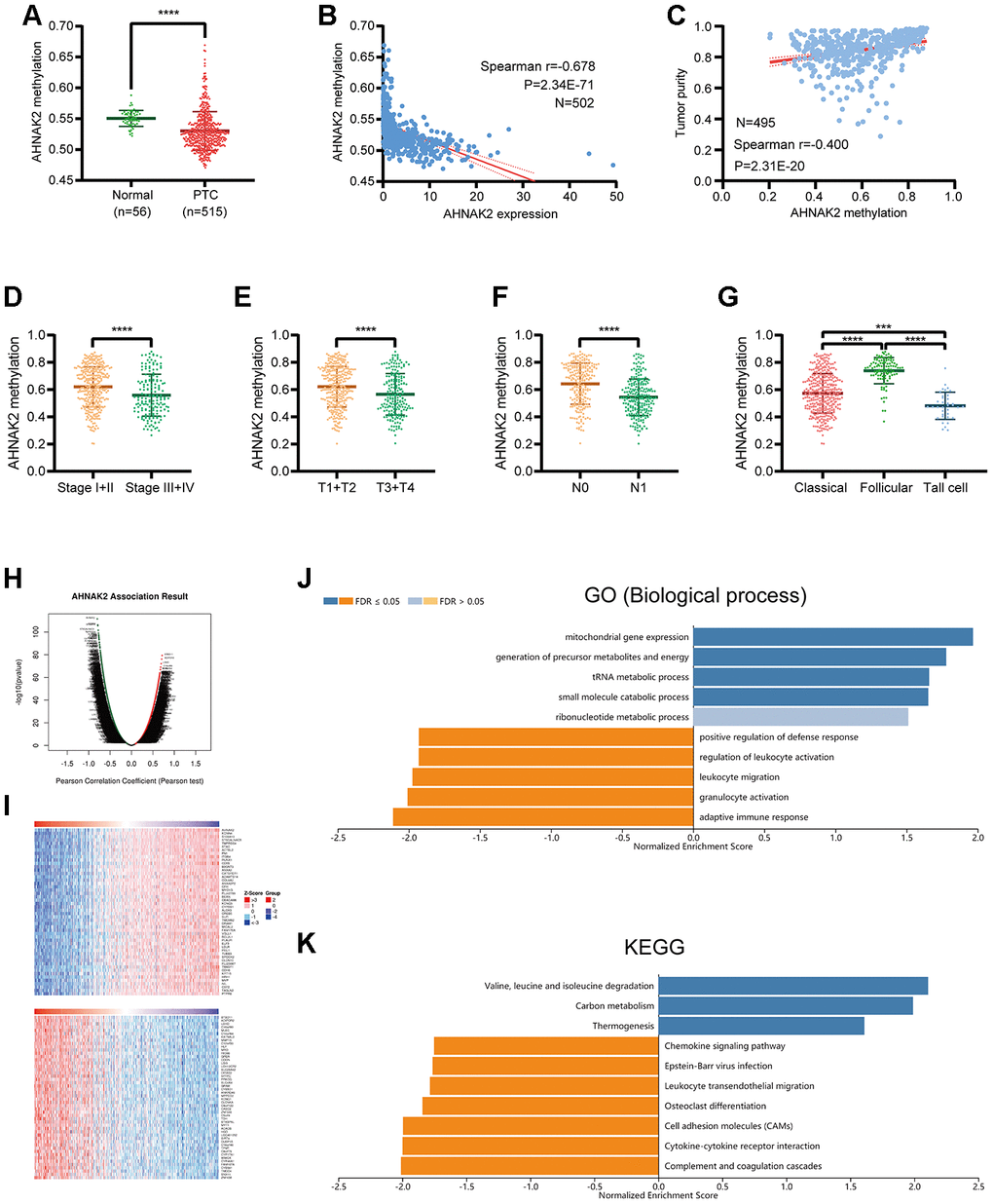 Analysis of AHNAK2 methylation in PTC. (A) AHNAK2 methylation levels were compared between PTC and normal tissues. (B) Correlation analysis between AHNAK2 methylation and AHNAK2 expression in PTC. (C) Correlation analysis between AHNAK2 methylation and tumor purity in PTC based on LinkedOmics.AHNAK2 methylation levels among PTC patients with different (D) stages, (E) T classifications, (F) N classifications, and (G) histological types. (H) AHNAK2 methylation was highly correlated with genes identified by the Pearson test in the THCA cohort based on LinkedOmics. (I) Heatmaps of the top 50 genes positively and negatively correlated with AHNAK2 in TCHA based on LinkedOmics. (J) Significantly enriched GO biological process analysis and (K) KEGG pathways of AHNAK2 methylation in the THCA cohort.