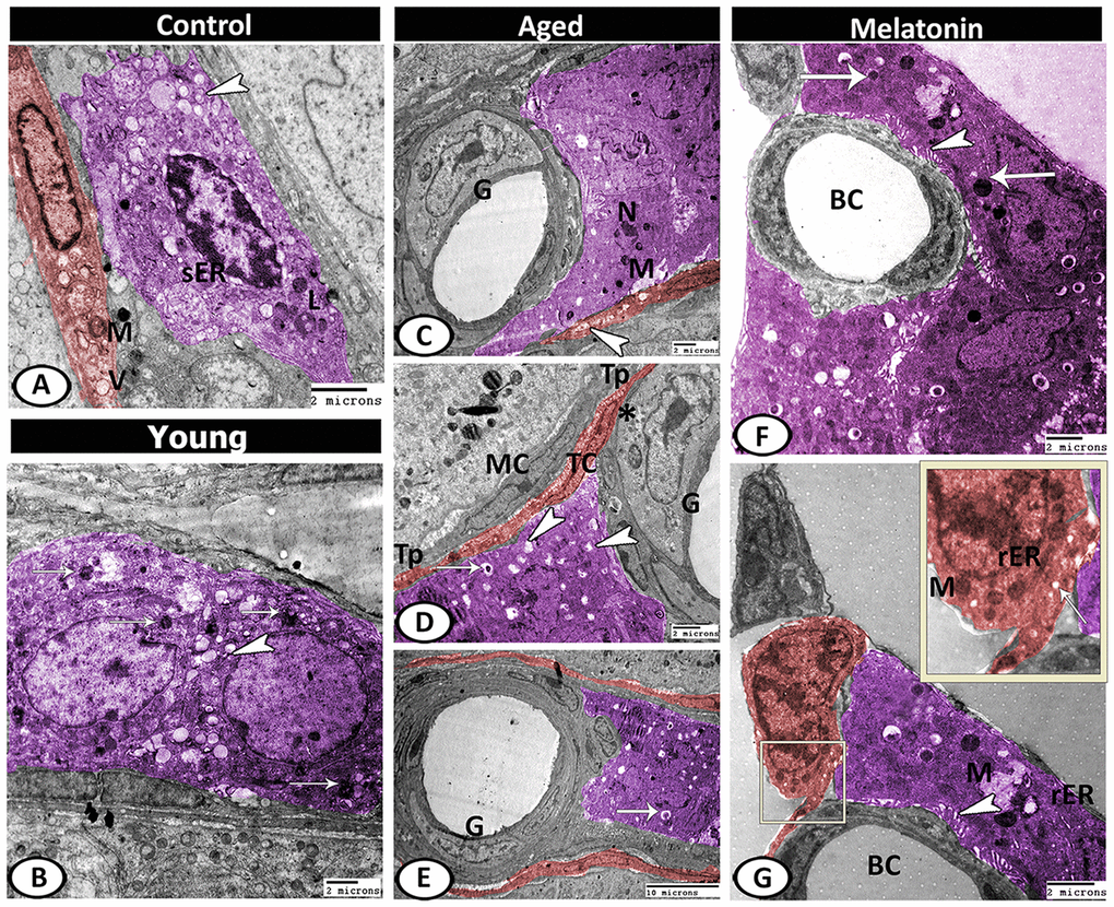 Digitally colored TEM image showing the ultrastructural changes in the interstitial tissues of young and aged mice. (A) In the control group, the Leydig cells (violet) contained lipid droplets (arrowhead), sER, lysosomes (L). Telocytes (TCs, red) contained secretory vesicles (V) and mitochondria (M). (B) In the young mutant mice, the Leydig cells (violet) characterized by an increase the number of lipid droplets (arrowhead) and lysosomes (arrows). (C) In aged mice, Leydig cell showed few mitochondria (M) and pyknotic nucleus (N). Note, the presence of TC (red) that contained many secretory vesicles (arrowhead) and the special type of blood vessel that characterized by the presence of large glomus cells (G). (D, E) Leydig cell (violet) contained many lipid droplets (arrowheads), and residual bodies (arrows). The glomus cell (G) was characterized by a high number of mitochondria (asterisk). The telocytes (red, TC) extended their telopodes (Tp) to establish close contact with Leydig cells, myoid cells (MC) and glomus cell (G). (F, G) In melatonin group, Leydig cells (violet) showed many mitochondria (M), secretory granules (arrows), rER, well-developed microvilli (arrowheads) that extended to the blood capillaries (BC). TCs (red) showed mitochondria (M), secretory vesicles (arrow) and rER.