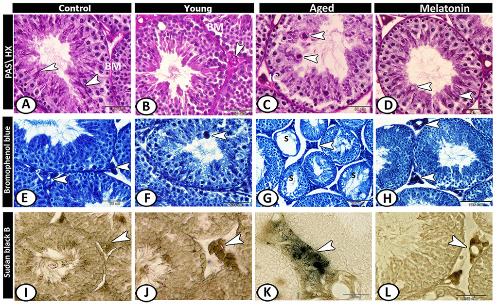 Histochemical analysis of testis of the young and aged mice. (A) In the control group, the basement membrane (BM) of seminiferous tubules, Sertoli cells and sperms (arrowheads) showed staining affinity to PAS. (B) In the young mutant mice, the basement membrane (BM) appeared thick and PAS-positive and the interstitium is PAS-positive (arrowhead). (C) In aged mice, Leydig cells (IC) and giant cells (arrowheads) in the seminiferous tubules showed strong PAS-positive reactions. (D) In melatonin group, Sertoli cells and their associated spermatids (arrowheads) showed PAS-positive reaction. (E) In the control group, the Leydig cells (arrowhead) showed affinity to bromophenol blue (BB). (F) In young mutant mice, some giant cells (arrowhead) reacted positively to BB. (G) In aged mice, the degenerated seminiferous tubules (S) showed no or weak affinity to BB, while Leydig cells (arrowhead) showed strong BB- positive reactions. (H) In the melatonin group, the reaction was concentrated in Leydig cells (arrowheads). (I) Sudan black B stain showed a weak reaction in Leydig cells (arrowhead) of the control group. (J) A moderate reaction in Leydig cells (arrowhead) of young mice. (K) An evident increase in the number of positive- lipid droplets in interstitial cells (arrowhead) was observed in aged mice. (L) The reaction (arrowhead) was moderate in the melatonin group.