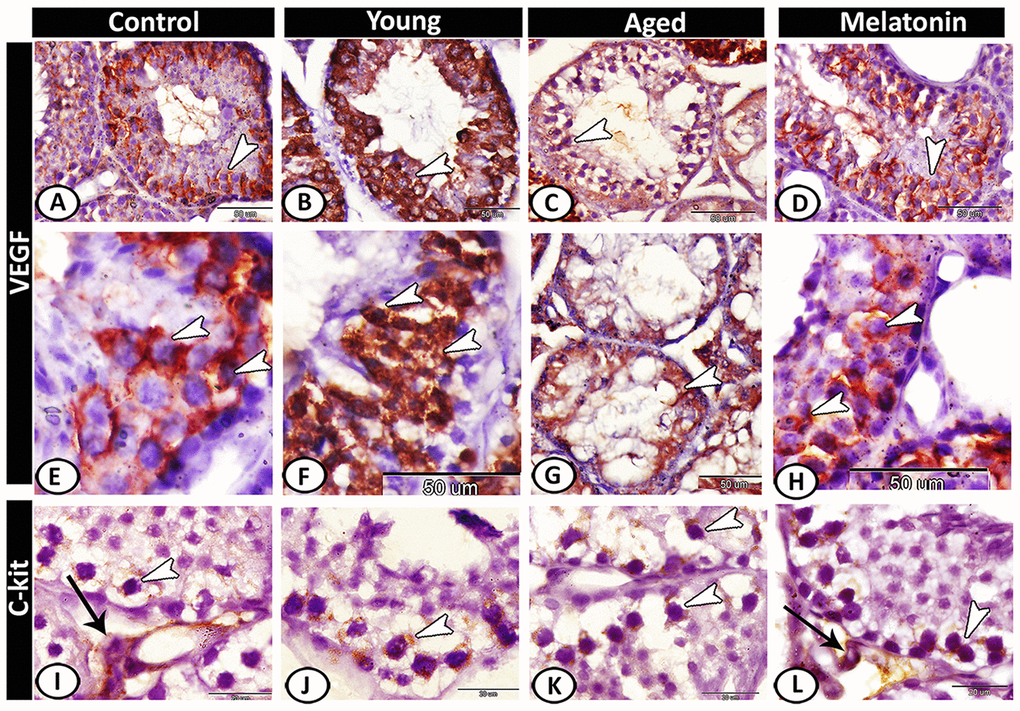 Immunohistochemical expression of VEGF and c-kit in young and aged mice. (A, E) VEGF expression in spermatocytes and spermatids (arrowheads) in the control group. (B, F) The young mutant mice showed overexpression of VEGF (arrowheads). (C, G) In aged mice, the reaction was weak and only the spermatocytes were immunostained (arrowheads). (D, H) In melatonin group, the reaction was concentrated in spermatocytes and spermatids (arrowheads). (I) c-kit expression was immunolocalized in spermatogonia (arrowhead) and interstitial cells (arrow) in the control group. (J, K) In young and aged mutant mice, the reactions were intense at the spermatogonial level (arrowheads). (L) The reaction in melatonin group was observed in spermatogonia (arrowhead) and Leydig cells (arrow).