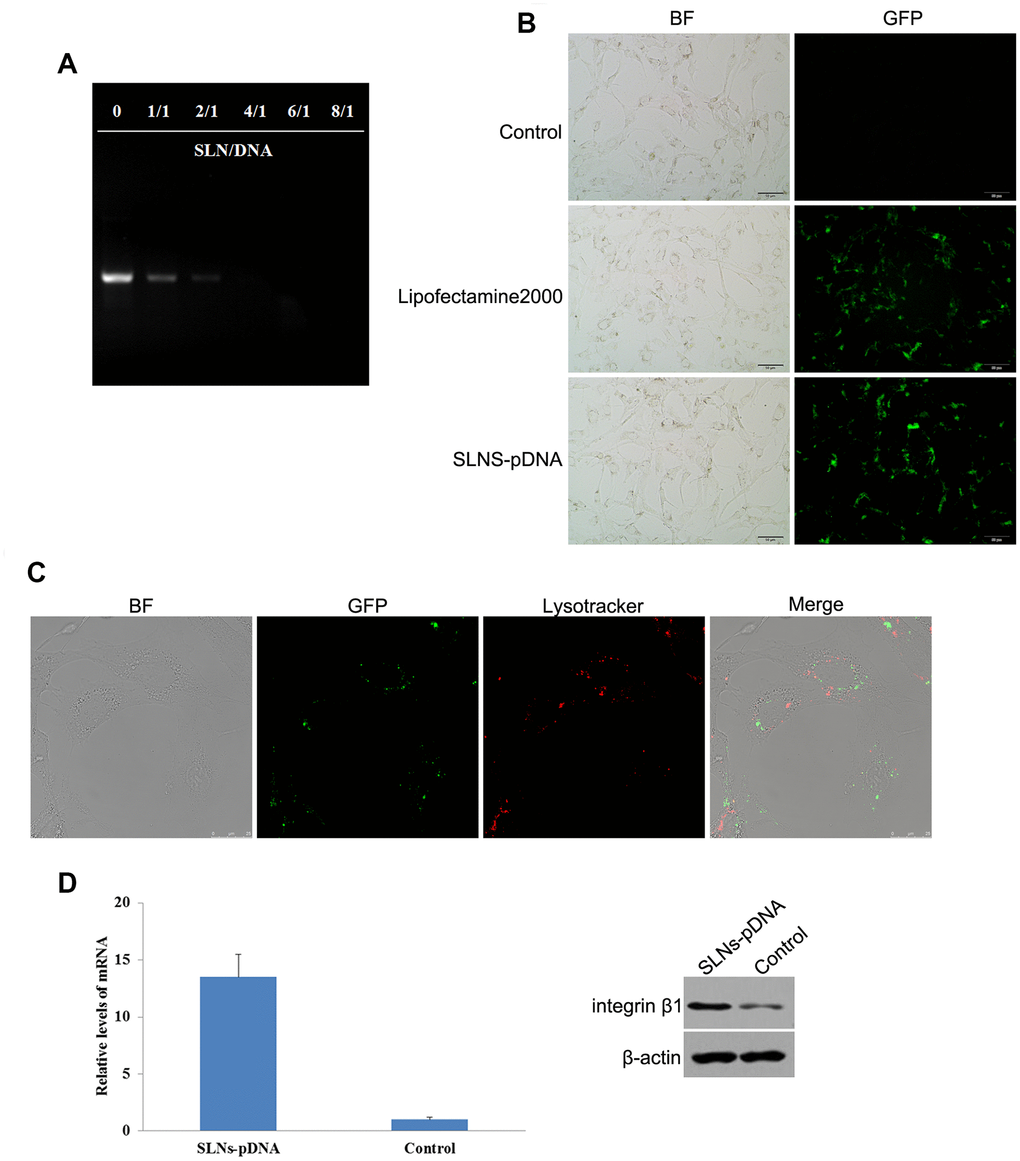Identification of solid lipid nanoparticles-integrin β1 overexpression plasmid (SLNs-pDNA). (A) Gel retardation assay of naked pDNA and SLNs/pDNA complexes with the different mass ratio. (B) Fluorescent microscopy of rat chondrocytes transfected by pDNA (Lipofectamine2000) and SLNs-pDNA. (C) Intracellular distribution assay of SLNs-pDNA in rat chondrocytes. (D) The mRNA and protein levels of integrin β1 in cells treated with SLNs-pDNA using qRT-PCR and western blot assays, respectively.