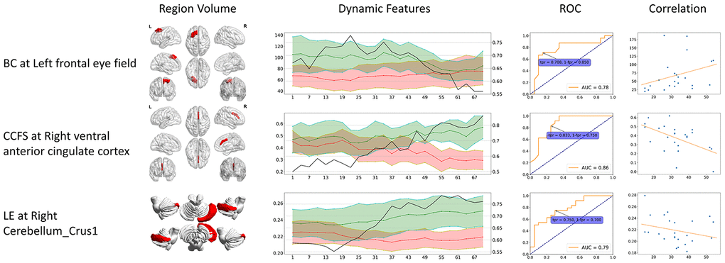 Abnormal Static And Dynamic Functional Connectivity Of Resting State