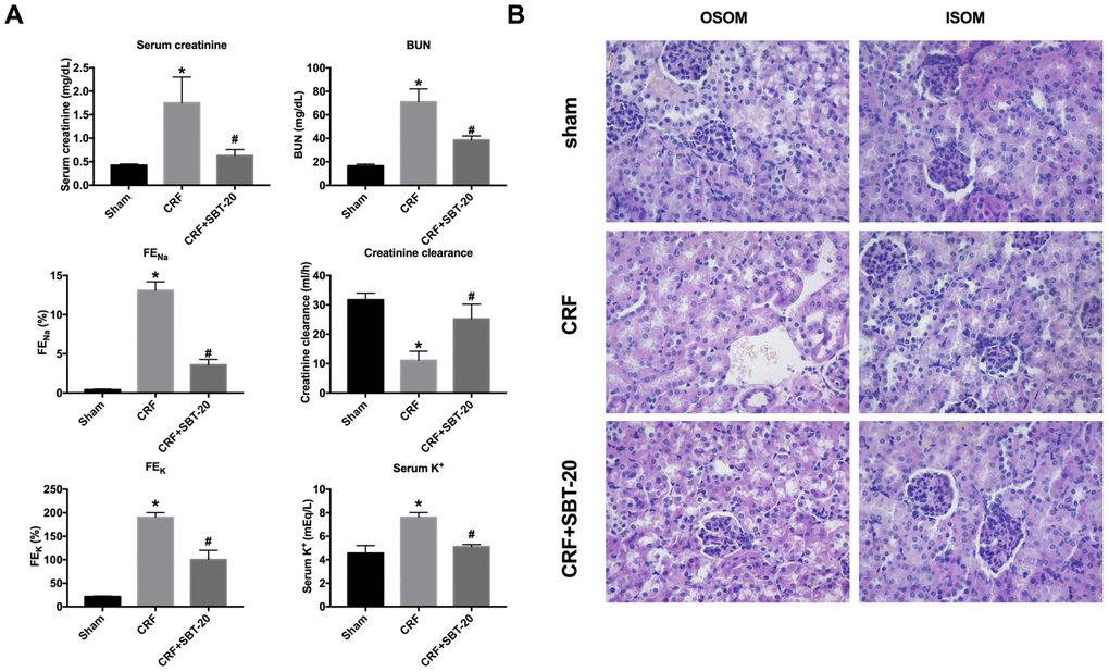 SBT-20 reduces renal injury in CRF mice. (A) The renal function of mice were evaluated (serum creatinine, BUN, FENa, serum K+, FEK, and creatinine clearance). n=6. (B) Representative image of H&E staining in the outer stripe of the outer medulla (OSOM) and inner stripe of the outer medulla (ISOM). (*Pvs. sham group, #Pvs. CRF group).