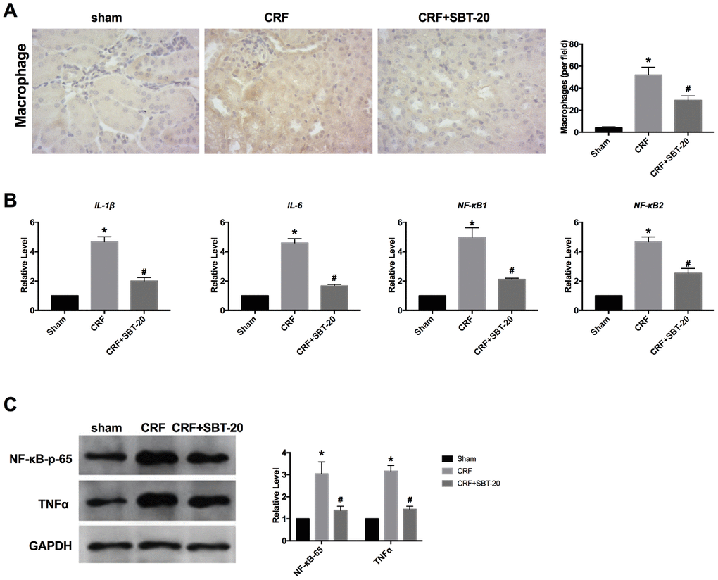 SBT-20 prevents inflammation in CRF mice. (A) Macrophage infiltration in different group. (B) The mRNA level of inflammatory cytokines (IL-1β, IL-6, NF-κB1 and NF-κB2). n=5. (C) The protein expression of NF-κB-p65 and TNFα in renal tissues. n=5. (*Pvs. sham group, #Pvs. CRF group).