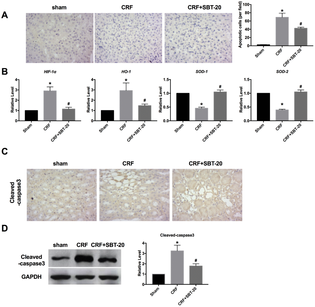 SBT-20 decreases oxidation in CRF mice. (A) TUNEL assay was performed in mice. (B) RT-PCR was performed to detect oxidative stress-relative markers, HIF-1α, HO-1, SOD1 and SOD2. n=5. (C) Cleaved-caspase3 expression intensity was evaluated by IHC assay. (D) Western blot was performed to measure the expression of cleaved-caspase3 in renal tissues. n=5. (*Pvs. sham group, #Pvs. CRF group).