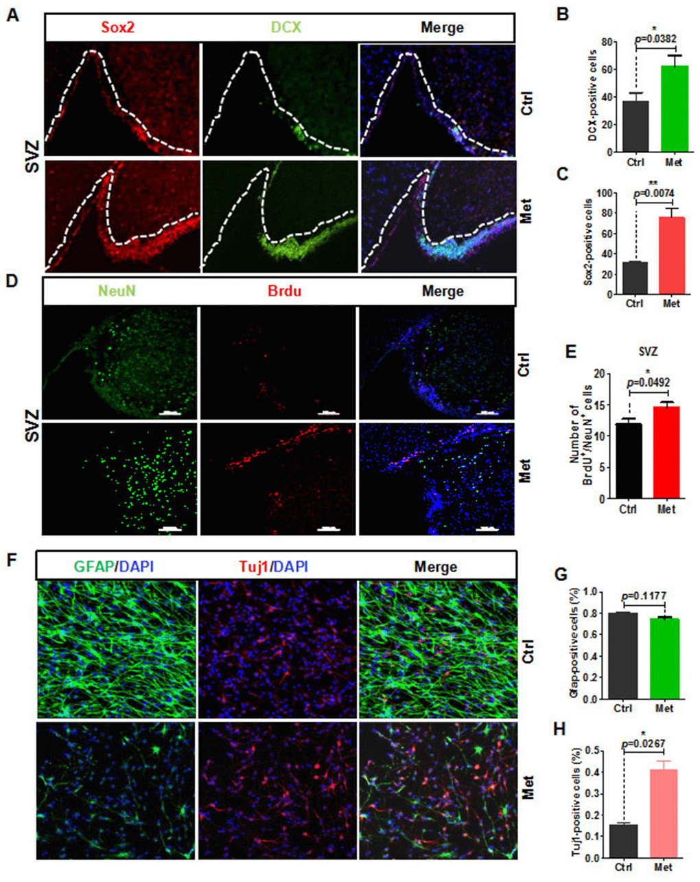 Metformin rejuvenation of neurogenic potential in aged mice. (A) The subventricular zone (SVZ) of old mice treated with metformin (n ≥ 3) immunostained with the neural stem cell marker, Sox2, and newborn neuronal marker, DCX. Right: Quantification of (B) Sox2+ cells and (C) DCX+ cells. (D) SVZ of old mice immunostained with the neuronal cell marker, NeuN, and cell proliferation marker, BrdU. Right: Quantification of (E) BrdU+ /NeuN+ cells to quantify newborn neurons. (F) Representative fields of GFAP and Tuj1 immunofluorescence staining of cultured neural stem cells treated with metformin after 7 days of spontaneous differentiation. Right: Statistical analysis of percentages of (G) GFAP+ cells and (H) Tuj1+ cells. Scale bar = 100 μm. Ctrl: Control; Met: Metformin. The overall significance between two groups was determined by Student’s t-test. * p p p 