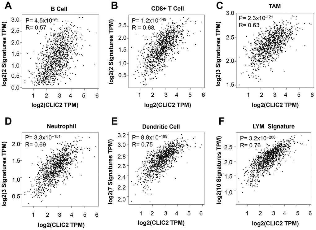 GEPIA2 found that CLIC2 highly expressed cancer was accompanied by increased markers of TILs. GEPIA2 was performed to assess the correlation between CLIC2 expression and markers of (A) CD8+ T cell, (B) B cell, (C) TAM, (D) neutrophil and (E) DC, and (F) LYM metagene signature. TAM, tumor- associated macrophage; DC, dendritic cell; LYM, lymphocyte-specific immune recruitment.