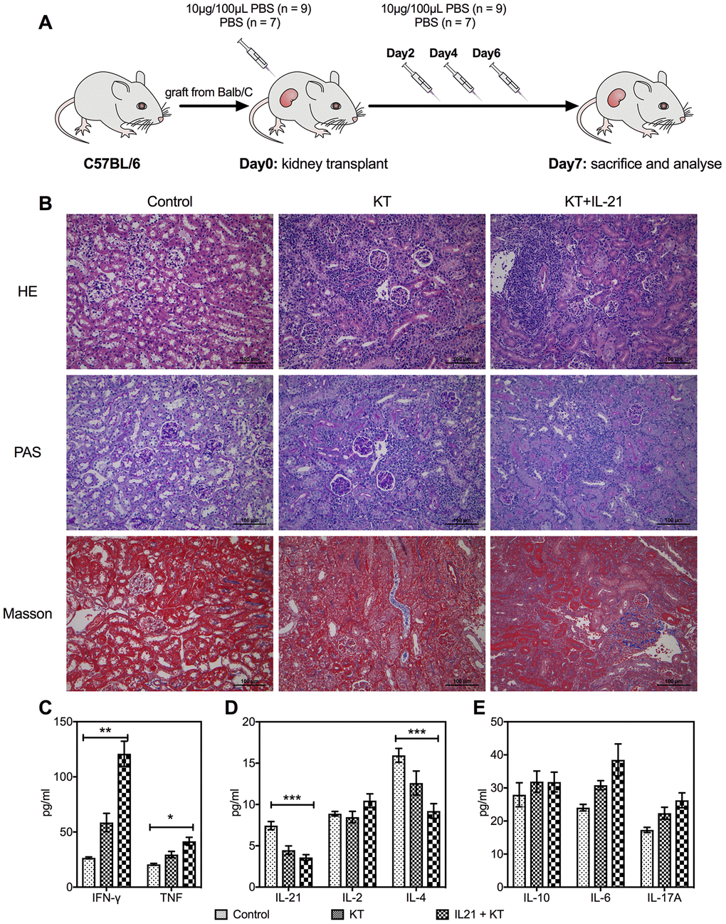 Exogenous IL-21 promotes inflammatory infiltration in the allograft. C57BL/6 mice received renal allografts from Balb/c mice. Kidney recipients were injected recombinant murine IL-21 (10 μg in 100 μL PBS; n = 9) or 100 μL PBS (n = 7) in the tail vein on days 0, 2, 4, and 6 after transplantation (A). Blank control (n = 3) of mice without transplantation received tail vein injection of PBS simultaneously. All animals were sacrificed 7 days post-transplantation. Histologic evaluation of kidney allografts from Control, KT, and IL-21+KT recipients on day 7 post-transplantation stained with (B) H&E, PAS, and Masson’s stains (scale bar: 100μm). Levels of (C) IFN-γ and TNF, (D) IL-21, IL-2, and IL-4, (E) IL-10, IL-6, and IL-17 in the transplanted kidney of KT subgroups and primary kidney of Control are shown. Values represent mean (±SEM). *P P P 