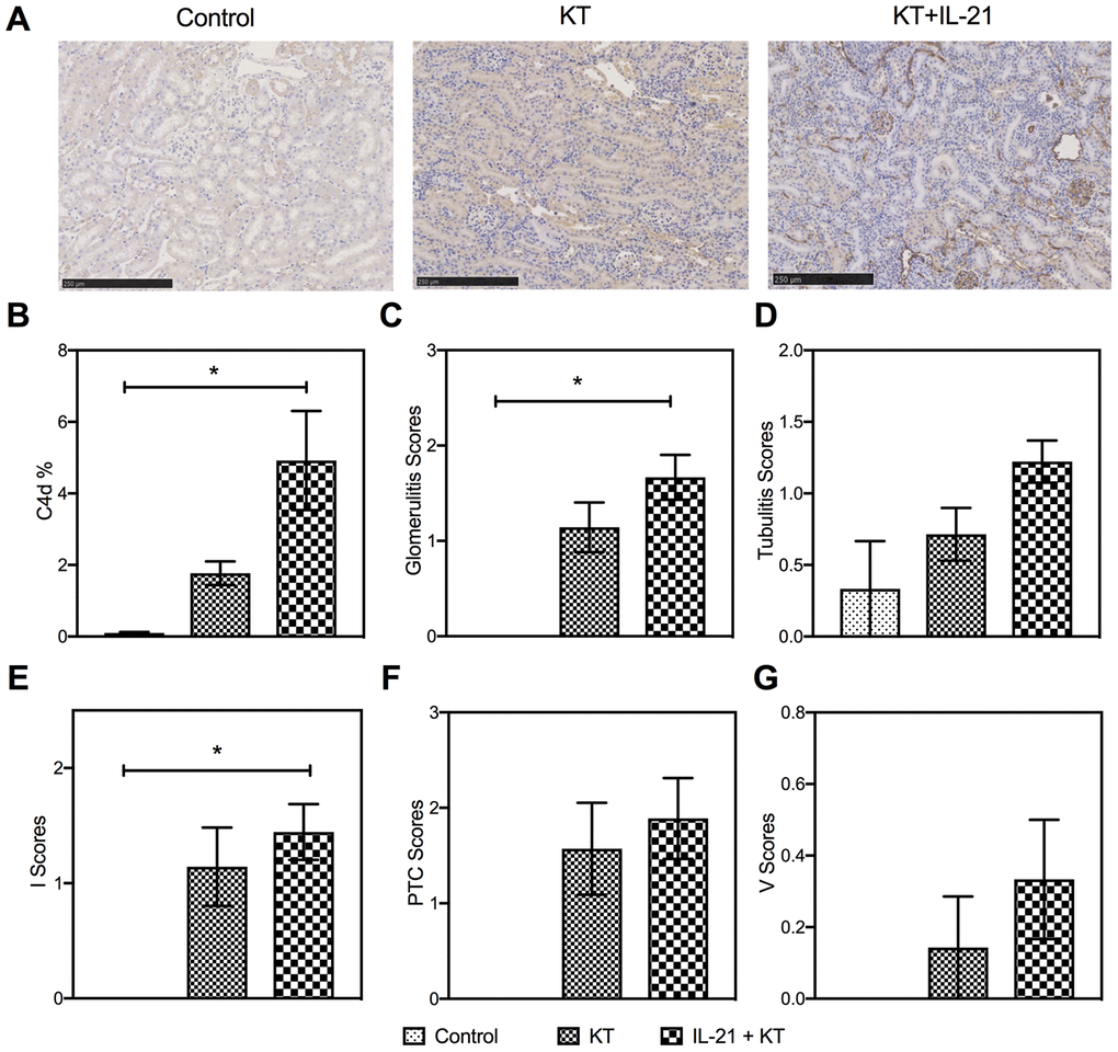 Exogenous IL-21 promotes active kidney rejection in mice. (A and B) Expression of C4d in the allograft (scale bar: 250μm). Histopathology scores of glomerulities, tubulitis, I, PTC, and V (C–G) of the kidney allografts from Control, KT, and IL-21+KT recipients. Values represent mean (±SEM). *P P P 