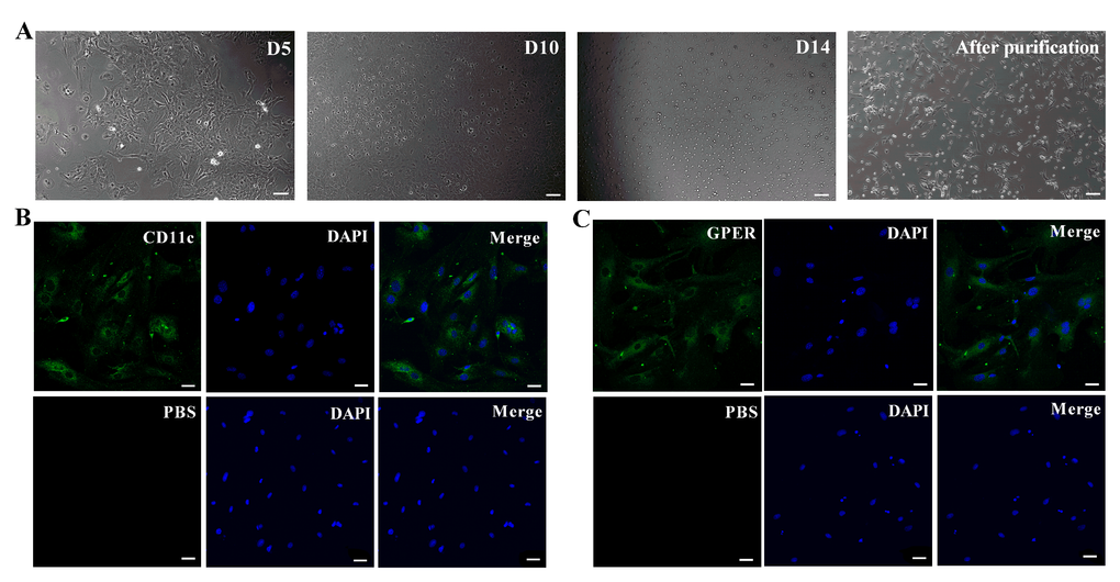 Basic characterization of primary murine retinal microglia. (A) The representative images (100×, Bar=10μm) show in vitro cultured primary retinal microglia cells on days 5 (D5), 10 (D10) and 14 (D14). (B) Representative confocal fluorescence microscopic images (400×; Bar=25μm) show Alexa Fluor 488-tagged anti-CD11c antibody (green) staining of primary murine retinal microglia. The negative control cells are treated with PBS instead of the primary anti-CD11c antibody. (C) Representative confocal fluorescence microscopic images (400×; Bar=25μm) show Alexa Fluor 488-tagged anti-GPER antibody (green) staining of primary murine retinal microglia. The negative control cells are treated with PBS instead of the primary anti-GPER antibody.