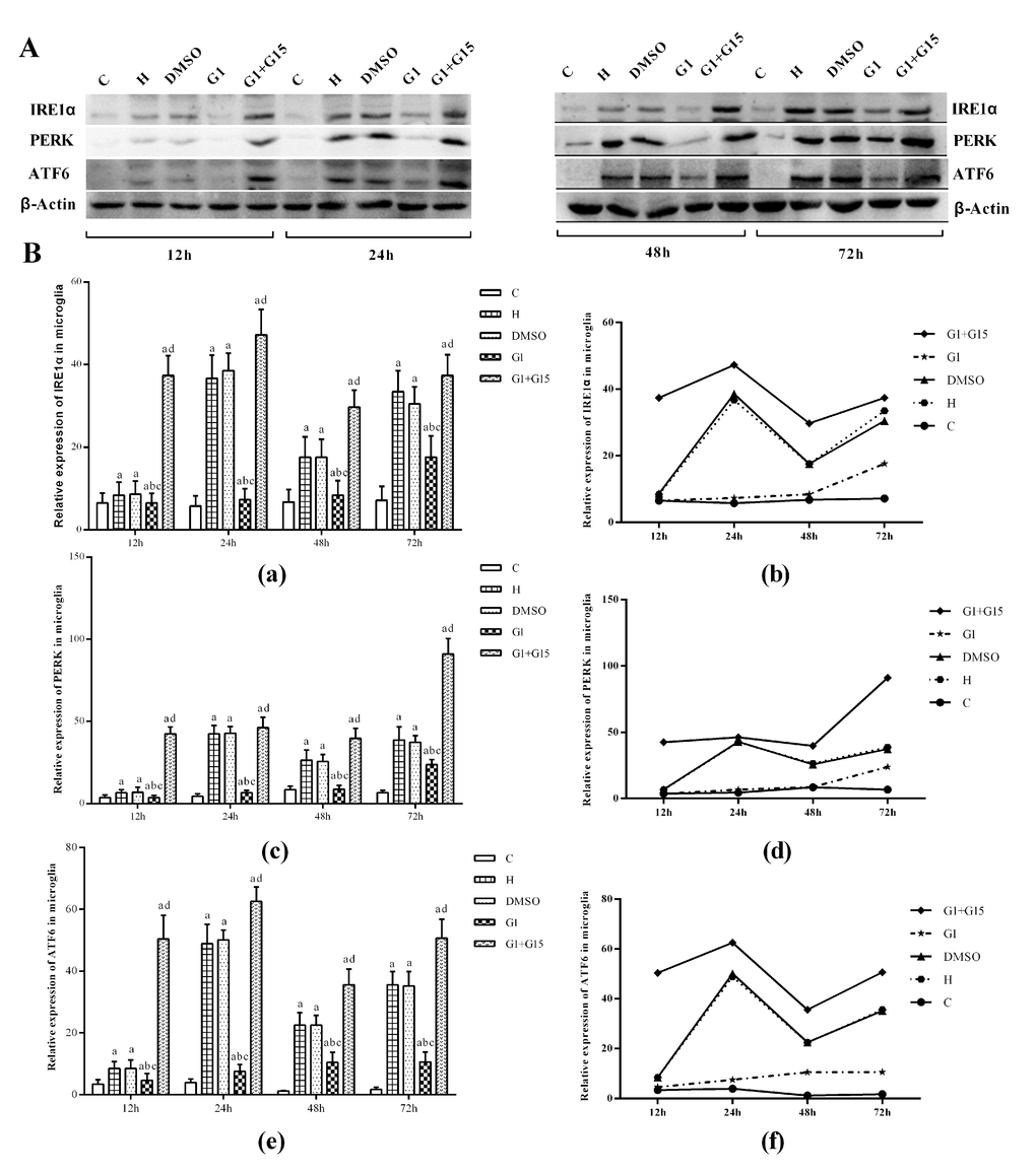 GPER activation reduces induction of ER-stress related proteins in hyperoxia-treated primary retinal microglia. (A) Representative western blot images and (B) Histogram plots show the levels of IRE1α, PERK and ATF6 proteins in the (a) control (C), (b) hyperoxia (H), (c) hyperoxia+DMSO (DMSO), (d) hyperoxia+G-1 (G-1), and (e) hyperoxia+G-1+G-15 (G-1+G-15) groups of primary retinal microglia at 12h, 24h, 48h and 72h. β-actin was used as internal control. P