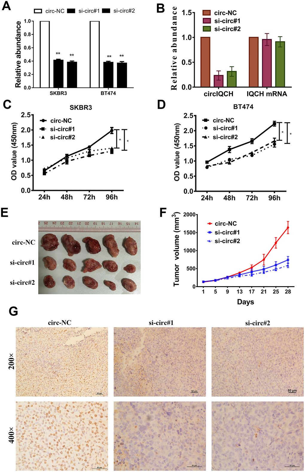 Downregulation of circIQCH suppresses the proliferation of breast cancer cells. (A) Knock down of circIQCH was assessed by qRT-PCR analysis. (B) si-circIQCH decreased the expression of circIQCH while had no effect on linear IQCH mRNA. (C, D) CCK-8 assays detected cell proliferation. (E) Mouse xenograft models were established. (F) Tumor volume was estimated in every four days. (G) The xenograft tumors were analyzed by immunohistochemistry analysis, and the representative images of ki-67 expression are presented. *P**P