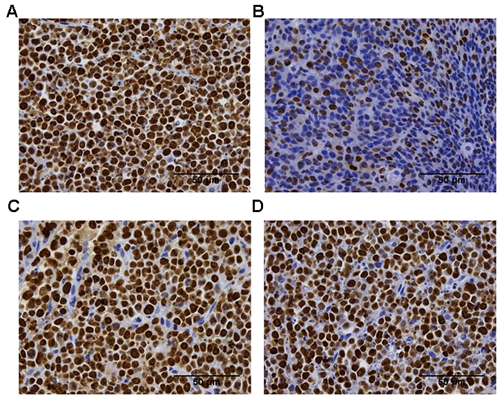 Ki-67 immunohistochemistry analysis of the proliferation of the tumor tissue in the difference groups. Ki-67 staining in the vehicle group (A), the 200 mm3 group (B), the 400 mm3 group (C), and the 800 mm3 group (D); n = 5 mice per group. Data are statistically significant for anti-CTLA-4 antibody 10 mg/kg intraperitoneal injection weekly; **, P 3), no IHC staining is shown due to the small tumor volume on the final day.