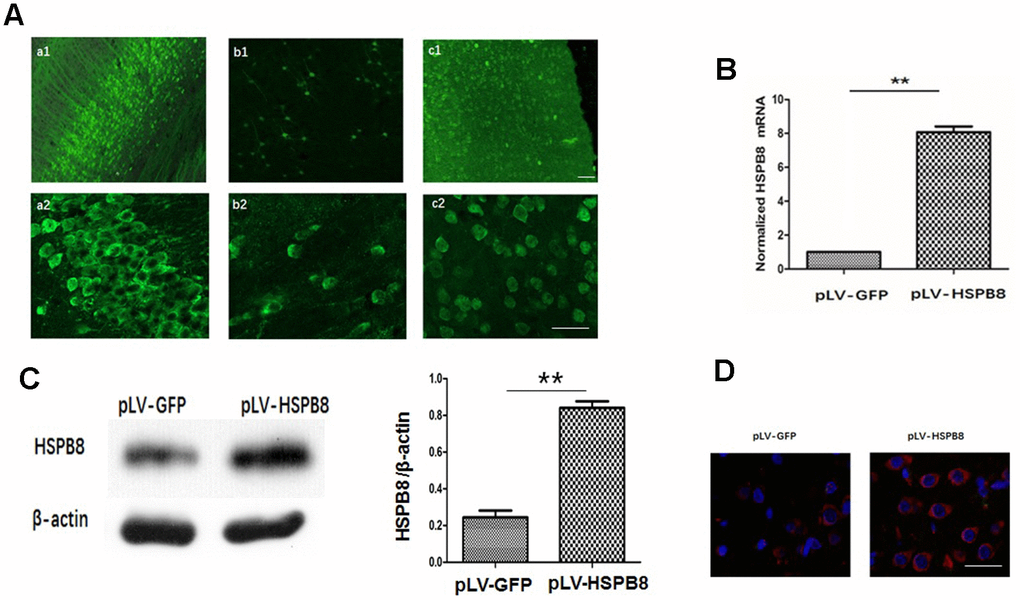 Lentivirus i.c.v administration mediated HSPB8 overexpression in brain tissues. (A) Representative fluorescent images labeled with anti-green fluorescent protein (GFP). a1, b1, and c1 were images at lower magnification in the hippocampus, striatum and cortex; a2, b2, and c2 were at higher magnifications. (B) RT-PCR result analysis (n=5, mean±SEM). (C) Western blotting and quantification of HSPB8 protein (n=5, mean±SEM). (D) Representative photomicrographs of immunostaining for HSPB8 (red) and DAPI (blue). Scale bars = 50 μm. **P