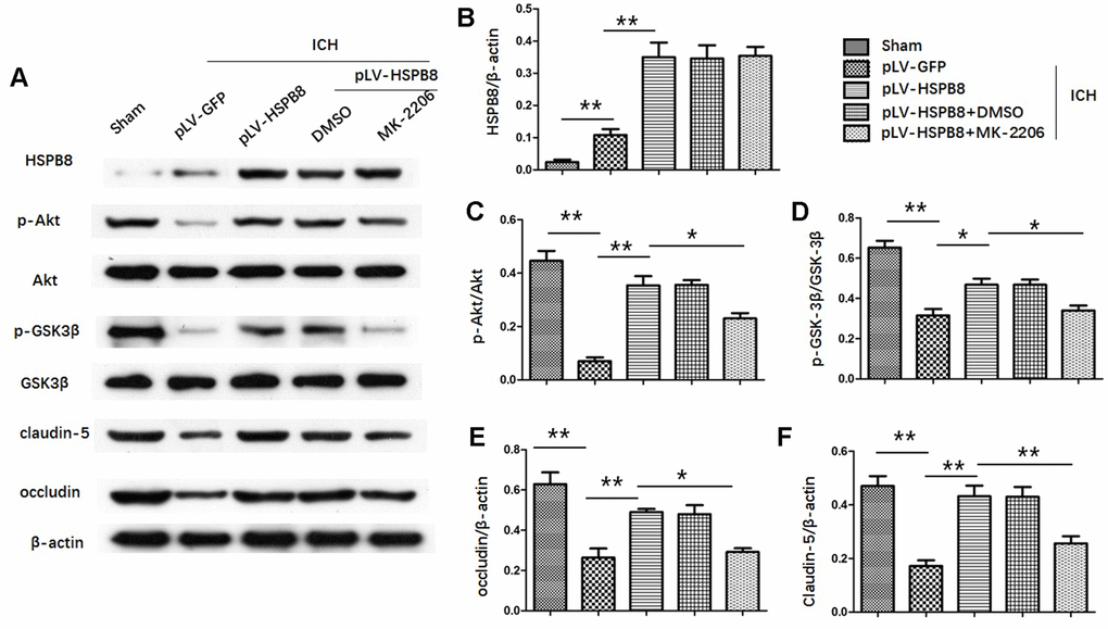 HSPB8 activated Akt/GSK3β pathway and Akt inhibition abolished the restorative effect of HSPB8 on TJPs. (A) Western blot analysis was performed to measure the protein levels of HSPB8, p-Akt, Akt, p-GSK3β, GSK3β, occludin and claudin-5. (B–F) Quantitative analysis of western blot analyses (n=6, mean± SEM). *P 