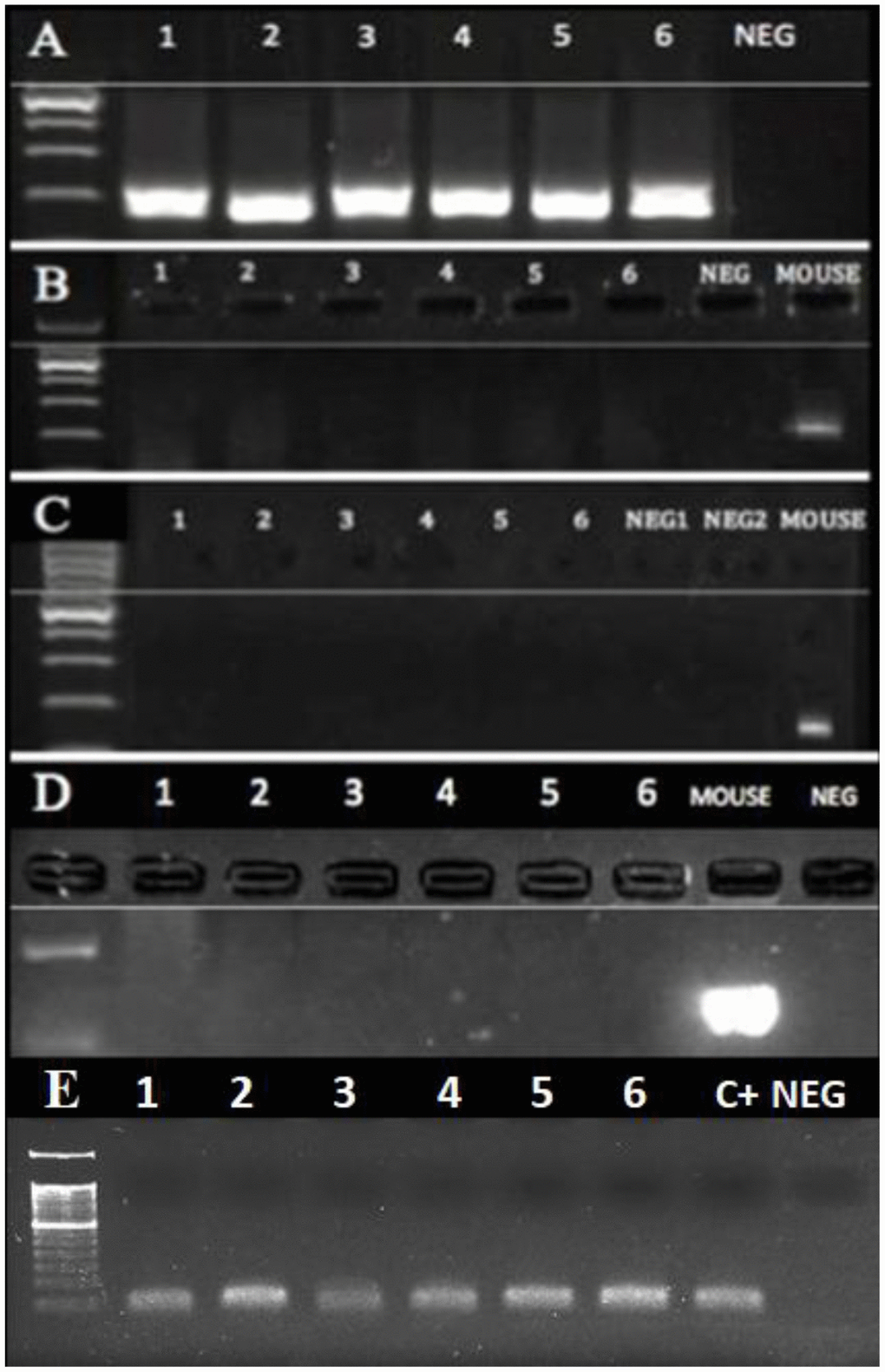 PCR of DNA extracted from the dental calculus. No mouse DNA was present in the six human cases (1-6) that were positive for MMTVels. (A) A 16S rRNA V3 region; all human cases were positive, whereas NEG was the negative control. (B) Intracisternal A Particle (IAP) LTRs; all the human cases were negative, as well as the negative control, whereas the mouse DNA was positive. (C) Murine mitochondrial DNA (mtDNA); all human cases were negative, whereas the mouse DNA was positive. (D) Murine GADPH; all the human cases were negative, whereas the mouse DNA was positive. (E) Human GADPH; all the human cases were positive; c+: a positive human control; neg: a negative control.