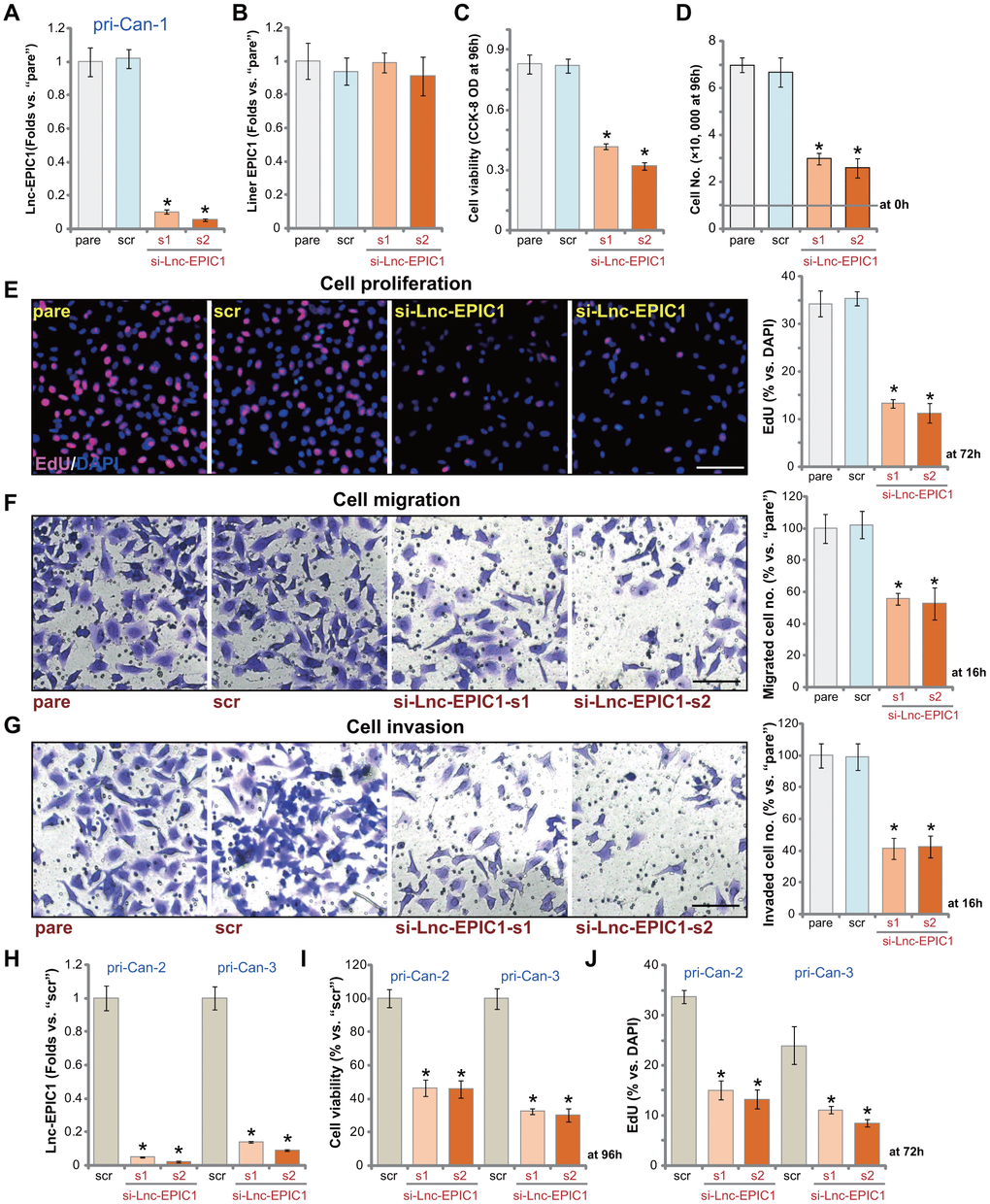 Lnc-EPIC1 siRNA inhibits colon cancer cell growth, proliferation, migration and invasion. The primary human colon cancer cells, pri-Can-1/-2/-3, were transfected with scramble control siRNA (“scr”, 500 nM) or the applied Lnc-EPIC1 siRNA (si-Lnc-EPIC1-s1/si-Lnc-EPIC1-s2, 500 nM), cells were further cultured for 48h, and expression of Lnc-EPIC1 and linear EPIC1 was tested by qPCR assays (A, B, H); Cells were further cultured for applied time periods, cell viability was examined by CCK-8 assays (C, I); Cell growth and proliferation were examined by cell counting assay (D) and nuclear EdU staining (E, J). Cell migration and invasion were tested by “Transwell” (F) and “Matrigel Transwell” (G) assays, respectively. For EdU studies, ten random views of each treatment were included to calculate the average EdU ratio (% vs. DAPI, same for all Figures). For “Transwell”/“Martial Transwell” assays, in each condition ten random views were included to calculate the average number of migrated/invaded cells (same for all Figures). The exact same number of viable colon cancer cells with different genetic modifications were initially seeded into each well or each dish (at 0h, same for all Figures). “pare” stands for the parental control cells (same for all Figures). Data presented as mean ± standard deviation (SD). * pE–G).