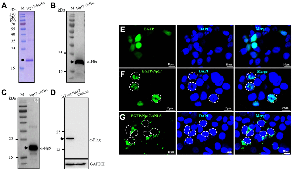 Np17 gene expresses a nuclear protein of ~17 kDa. (A) Np17 gene expressed a ~17 kDa protein in bacteria. (B, C) Western blotting result of recombinant Np17 protein with His-tag antibody (B) and with Np9 antibody (C). (D) Np17 gene expressed a ~20 kDa protein in human leukemia cells. (E) EGFP alone stained the cell uniformly in HEK293 cells. (F) EGFP-Np17 protein is localized predominantly in the cell nucleus in HEK293 cells. (G) EGFP-Np17-ΔNLS was localized in the cytoplasm in HEK293 cells.
