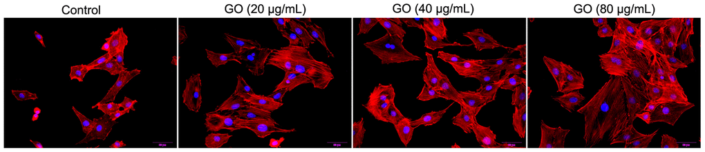 Graphene oxide (GO) destroyed actin cytoskeleton of Hela cells. Actin cytoskeleton of Hela cells treated with different doses of GO under confocal microscopy.
