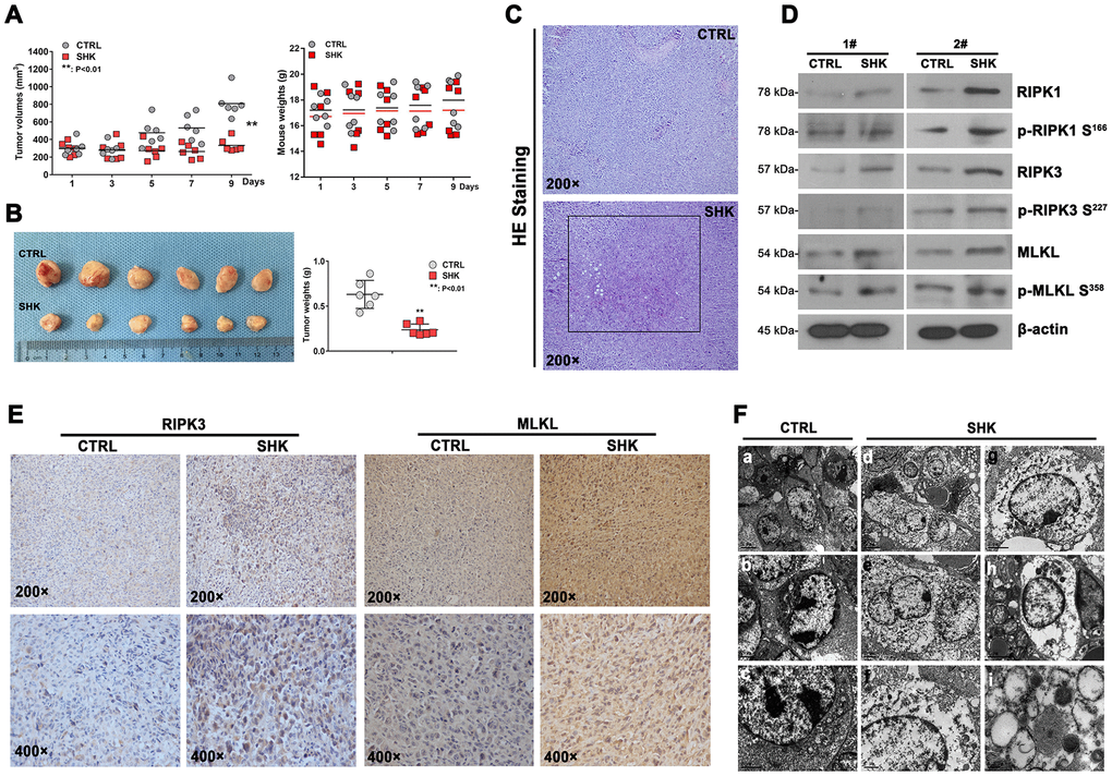 Shikonin inhibits the growth of TKI-resistant CML cells in vivo. (A) Quantification of mouse weights and mean tumor volumes. NOD/SCID mice were subcutaneously implanted with 32Dp210-T315I cells and treated i.p. with shikonin or PBS (as control) daily for 9 days (n = 6 mice/group). Data are presented as mean ± SD. **p B) Macroscopic appearance and mean weight of excised 32Dp210-T315I tumors. **p C) HE analysis showing distinct necrotic features in tumor samples from shikonin-treated mice. (D) Western blotting analysis of total and phosphorylated RIPK1, RIPK3, and MLKL expression in 32Dp210-T315I tumor samples. (E) Immunohistochemical analysis of RIPK3 and MLKL expression in tumor tissues. (F) Morphological analysis of tumor tissues via electron microscopy. Bars: 5 μm (a and d), 2 μm (b, c, e, g, and h), 1 μm (f), and 0.2 μm (i).
