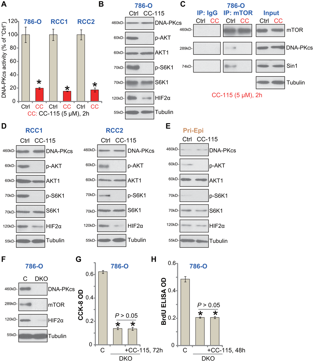 CC-115 blocks DNA-PKcs and mTOR activation in RCC cells. 786-O RCC cells, the primary human RCC cells (“RCC1/2”), or the primary human renal epithelial cells (“Pri-Epi”), were treated with CC-115 (“CC”, 5 μM) for 2h, DNA-PKcs activity (A) and expression of listed proteins in total cell lysates (B, C-”Inputs”, D, E) were shown. mTOR-Sin1-DNA-PKcs association was tested by co-immunoprecipitation assay (C, “IP”). Expression of the listed proteins in control 786-O cells (“C”) and DNA-PKcs- and mTOR-double knockout (DKO) 786-O cells were shown (F), cells were also treated with/without CC-115 (5 μM) for 48/72h, cell viability and proliferation were tested by CCK-8 assay (G) and BrdU ELISA assay (H), respectively. The exact same number of “C” and DKO cells were plated initially (“0h”) for the functional assays (G, H). *P A). *P G, H).
