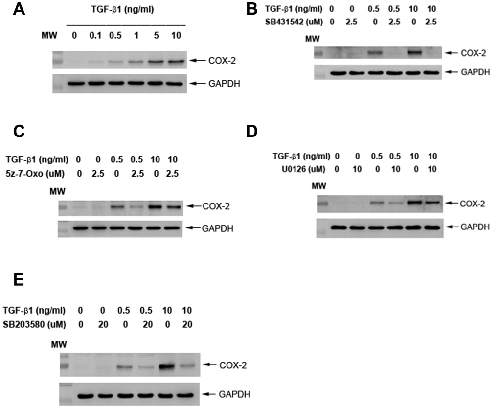 Effect of TGF-β1 on COX-2 protein expression of cultured SHED. (A) COX-2 protein expression of SHED after exposure to TGF-β1 for 24 hours. (B) Effect of SB431542 on the TGF-β1-induced COX-2 expression of SHED. (C) Effect of 5z-7oxozeaenol on the TGF-β1-induced COX-2 expression of SHED. (D) Effect of U0126 on the TGF-β1-induced COX-2 expression of SHED. (E) Effect of SB203580 on the TGF-β1-induced COX-2 expression of SHED. One representative western blot picture was shown.