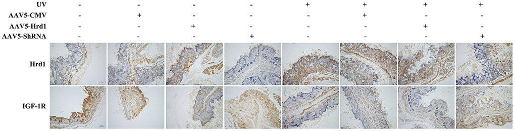 The effect of Hrd1 transfection on protein expressions of Hrd1, IGF-1R in mice by immunohistochemistry.