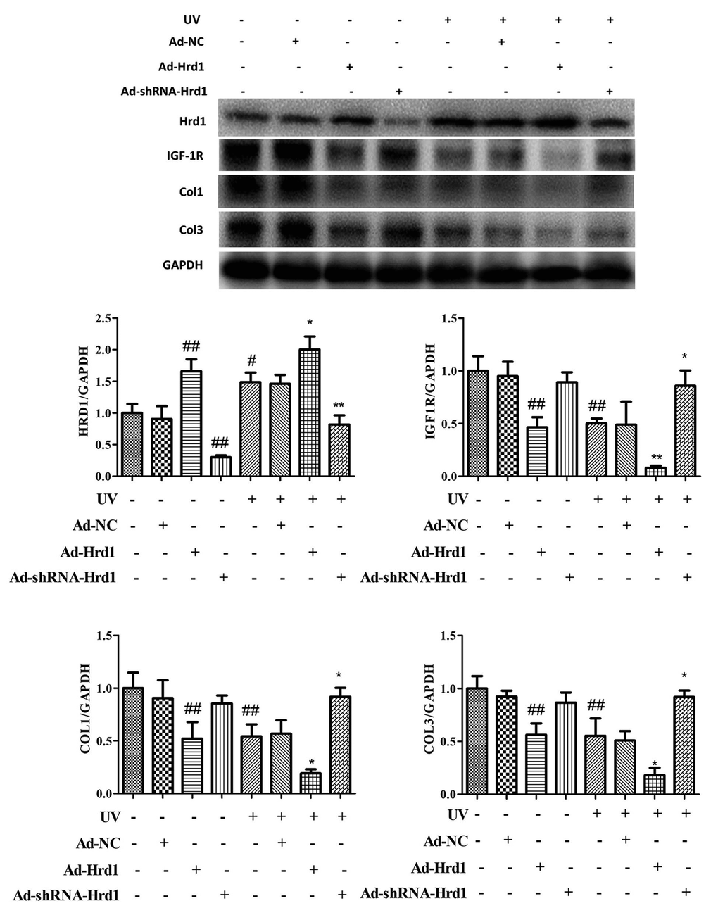 The effect of Hrd1 transfection on the protein expressions of Hrd1, IGF-1R, Type I collagen and Type III collagen by western blot in HSF cells. The results were presented as mean ± SD. ###