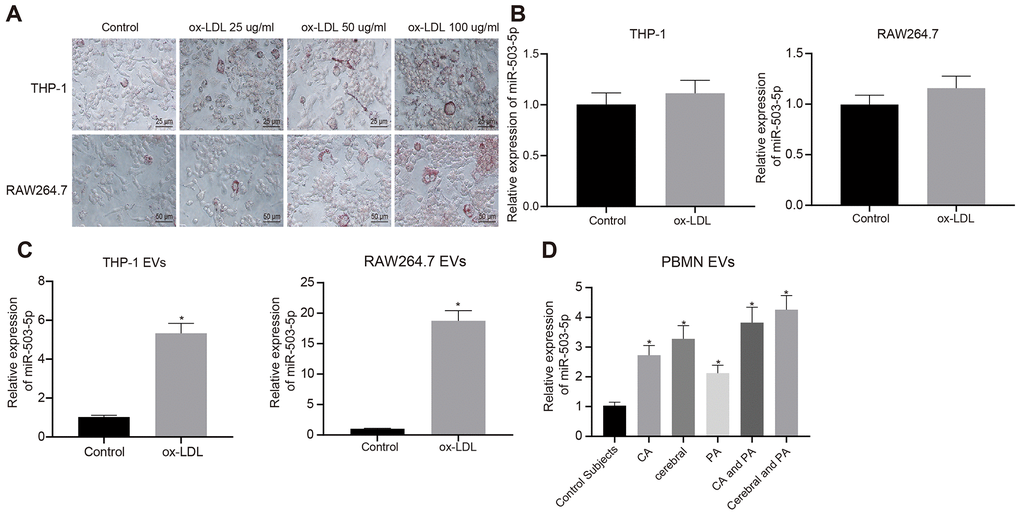 Expression pattern of miR-503-5p in macrophage-EVs in the context of atherosclerosis. PMA-induced THP-1 and RAW264.7 cells were treated with ox-LDL at doses of 25 μg/mL, 50 μg/mL and 100 μg/mL, respectively. (A) Foam cells (×200) in PMA-induced THP-1 and RAW264.7 cells detected by Oil red O staining. (B) Expression of miR-503-5p (normalized to U6) in PMA-induced THP-1 with or without ox-LDL treatment and their derived EVs determined by RT-qPCR. (C) Expression of miR-503-5p (normalized to U6) in PMA-induced RAW264.7 cells with or without ox-LDL treatment and their derived EVs determined RT-qPCR. (D) The expression of miR-503-5p (normalized to U6) in plasma-EVs of healthy individuals (n = 30) and patients with atherosclerosis (n = 53) determined by RT-qPCR. Values obtained from three independent experiments in triplicate were analyzed by unpaired t test between two groups and by one-way ANOVA followed by Tukey's post hoc test among three or more groups. *p 