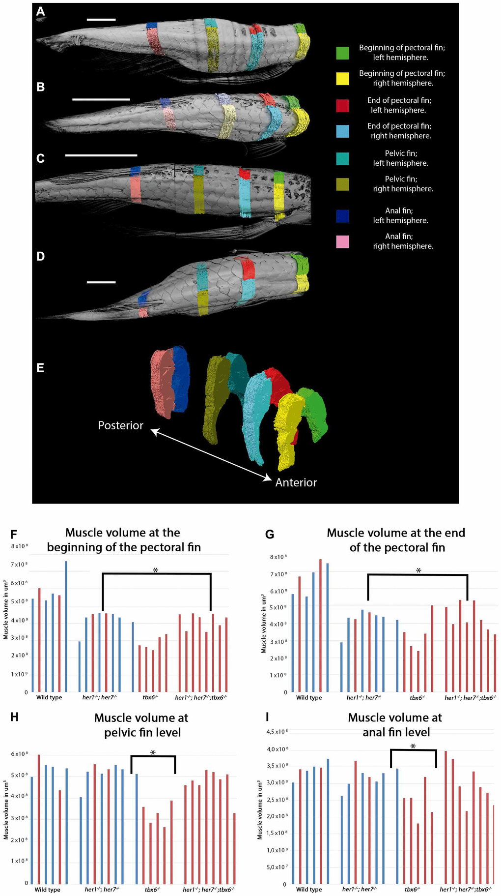 Muscle volume is affected in mutants at adult stages. (A–D) Representative micro CT images showing the dorsal view of fish used for the segmentation of muscles into the left and right side at the four key areas (indicated by the colored regions) in the 4 different groups: (A) wild type, (B) tbx6-/- (C) her1-/-;her7-/-, and (D) her1-/-;her7-/-;tbx6-/-. (E) Lateral view of reconstructed surface generation of the individual muscle from the WT. (F–I) graphical results of the volume measurements for every area. (F) Muscle volume at the beginning of the pectoral fin. (G) Muscle volume at the end of the pectoral fin. (H) Muscle volume at pelvic fin level. (I) Muscle volume at anal fin level. An asterisk denotes a statistically significant difference between wild type and mutant groups (two tailed significant test P=0,05). Individuals that presented scoliosis during the course of the experiment (represented with red bars) tend to have the same muscle volume as their phenotypically normal siblings (represented with blue bars). The three mutants analyzed have less muscle volume at the first two anterior positions. The muscle of 27 out of 32 individuals could be analyzed to 12 months, because two wild type fish (1 with scoliosis and 1 without scoliosis), one her1-/-; her7-/- individual (with scoliosis) and two tbx6-/- individuals (both with scoliosis) had to be euthanized between 9 months and one year. After the individual was removed, it was not stained for muscle analysis and therefore will not appear in the graph.