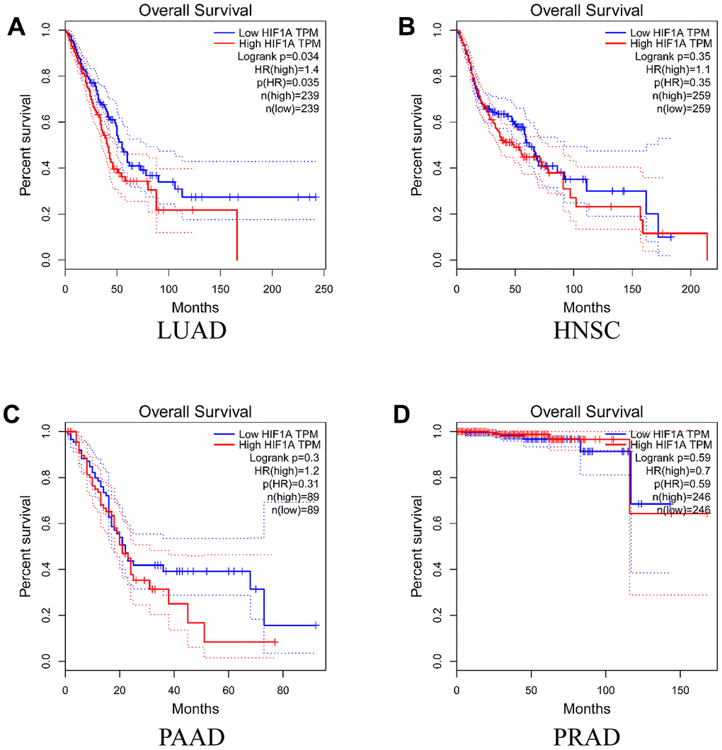 Overall survival time curves for different expression level of HIF-1α. (A) lung adenocarcinoma; (B) head and neck squamous cell carcinoma; (C) pancreatic adenocarcinoma; (D) prostate adenocarcinoma).