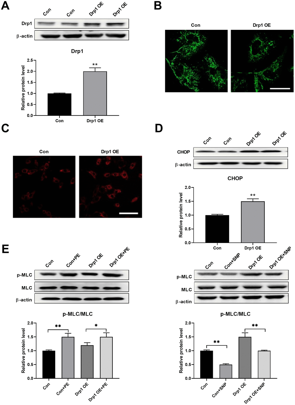 Drp1 overexpression induced ER stress. (A) Drp1 was overexpressed by adenovirus in PASMCs. Twenty micrograms of protein was loaded for each lane. (B) Overexpression of Drp1 induced mitochondrial fragmentation as detected by mitoTracker. Scale bar, 20 μm. (C) Overexpression of Drp1 increased mitochondrial ROS as detected by mitoSOX. Scale bar, 100 μm. (D) Drp1 overexpression increased CHOP expression in PASMCs. Twenty micrograms of protein was loaded for each lane. (E) Drp1 overexpression decreased PASMCs function as evidenced by decreased PE/SNP-induced MLC phosphorylation/dephosphorylation in PASMCs. Twenty micrograms of protein was loaded in each lane. *, p p 