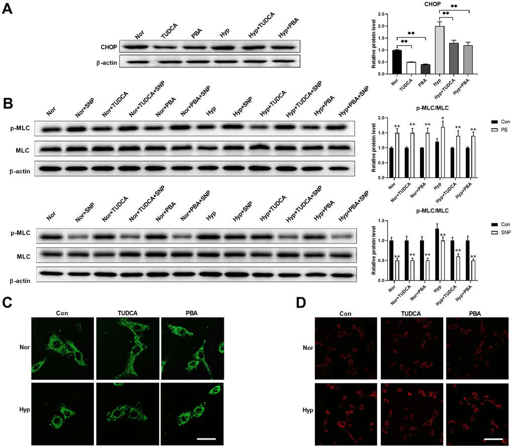 Inhibition of ER stress showed little effects on mitochondrial morphology but improved cell function in PASMCs under hypoxia. (A) PBA and TUDCA decreased CHOP expression in PASMCs under both normoxia and hypoxia. Twenty micrograms of protein was loaded in each lane. (B) PBA and TUDCA improved PASMC function as evidenced by increased PE/SNP-induced MLC phosphorylation in PASMCs under hypoxia. Twenty micrograms of protein was loaded in each lane. (C, D) PBA and TUDCA showed little effects on mitochondrial morphology (C) and mitochondrial ROS (D) in PASMCs under hypoxia. Scale bar, 20 μm in C and 100 μm in D. *, p p 