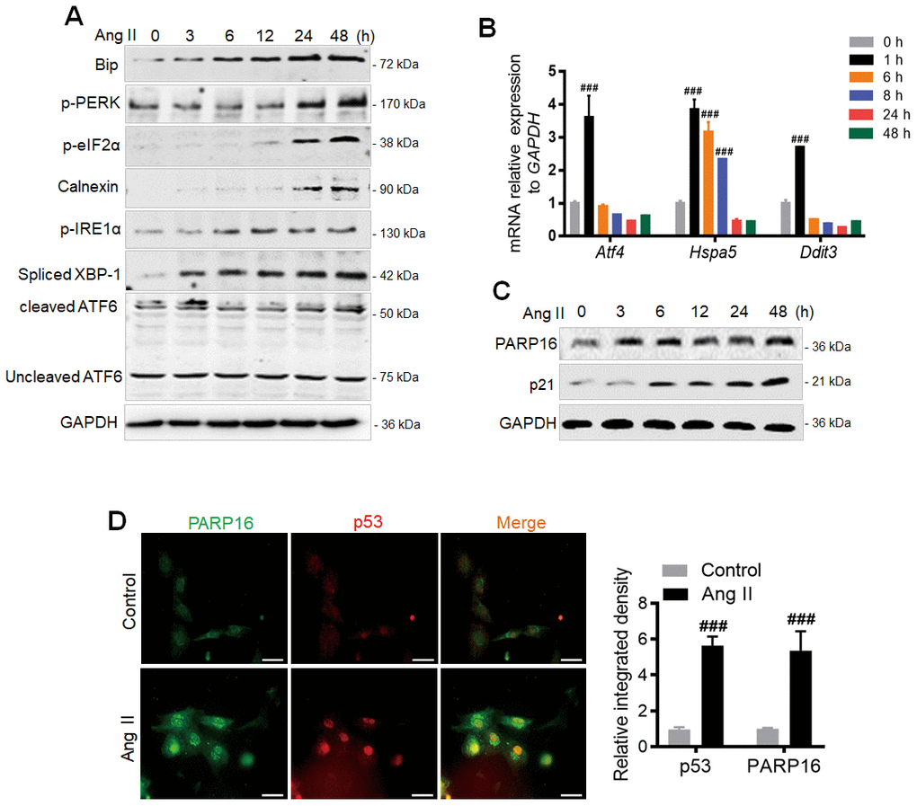 PARP16 is involved in Ang II-induced endoplasmic reticulum (ER) and endothelial cells senescence. (A) ER markers were upregulated after Ang II stimulation in RAECs. At 0, 3, 6, 12, 24 and 48 h after Ang II (2 μM) administration, cells extracts were collected for determining the protein levels. Data shown are representative of data from at least three different replicates. (B) qRT-PCR analysis of the UPR target genes (Hspa5, Ddit3, Atf4) after Ang II stimulation for indicated time in RAECs. Data shown are technically representative of data from at least three different replicates; ###p vs. 0 h. (C) PARP16 and senescence-associated marker p21 were upregulated after Ang II stimulation in RAECs. At 0, 3, 6, 12, 24 and 48 h after Ang II (2 μM) administration, cells extracts were collected for determining the protein levels. Data shown are representative of data from at least three different replicates. (D) Immunofluorescence double staining of PARP16 and p53, and quantitative analysis in RAECs upon Ang II treatment, ###p vs. control. ‘DAPI’ represents DAPI staining of nuclei (DNA) throughout the manuscript.