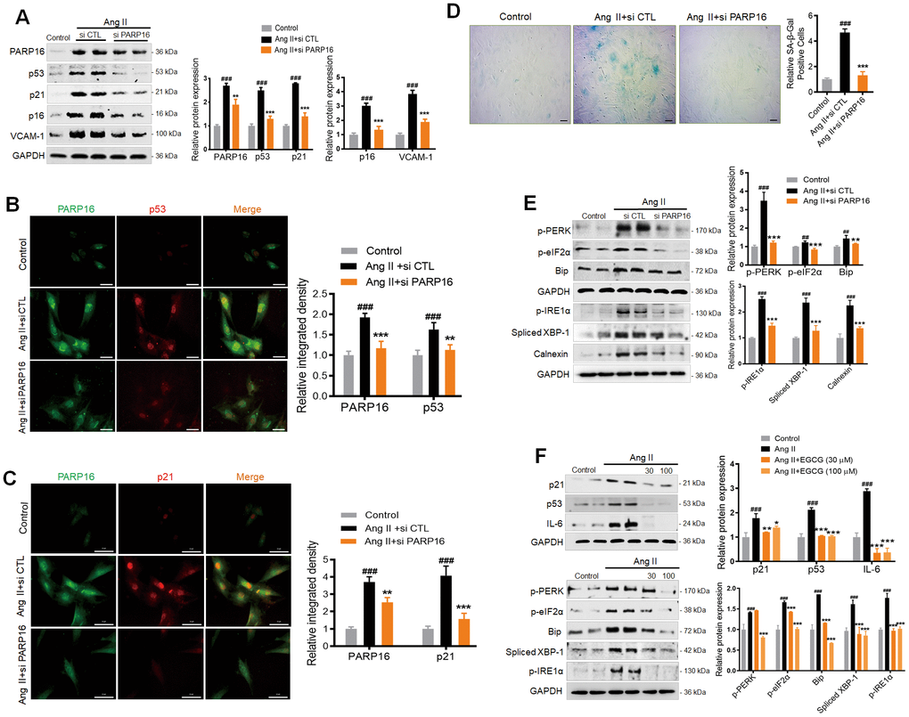Knocking down or inhibition of PARP16 mitigates Ang II-induced RAECs senescence and endoplasmic reticulum (ER) stress. (A–E) PARP16 knockdown reversed Ang II-induced RAECs senescence and endoplasmic reticulum stress. Senescence-associated markers (VCAM-1, p16, p21, and p53) were assayed by Western blot for RAEC cells transfected with control (si CTL) or PARP16 siRNA before and after Ang II (2 μM) treatment for 48 h (A); Immunofluorescence double staining of PARP16 and p53 (B), and Immunofluorescence double staining of PARP16 and p21 (C); SA-β-Gal staining for RAEC cells (D); ER-associated markers (Bip, p-PERK, p-eIF2α, p-IRE1α, spliced XBP-1 and Calnexin) were assayed by Western blot for RAEC cells transfected with control or PARP16 siRNA before and after Ang II treatment (E). (F) PARP16 inhibitor EGCG reversed Ang II-induced RAECs senescence and endoplasmic reticulum stress. p21, p53, IL-6, Bip, p-PERK, spliced XBP-1, p-IRE1α and p-eIF2α were assayed by Western blot for Ang II-induced RAEC cells with or without PARP16 inhibitor (EGCG) at different concentration. GAPDH serves as internal control. All data were shown as mean ± S.D of at least 4 independent experiments. ##p ###p vs. control; *p **p ***p vs. Ang II+si CTL or Ang II treated cells.