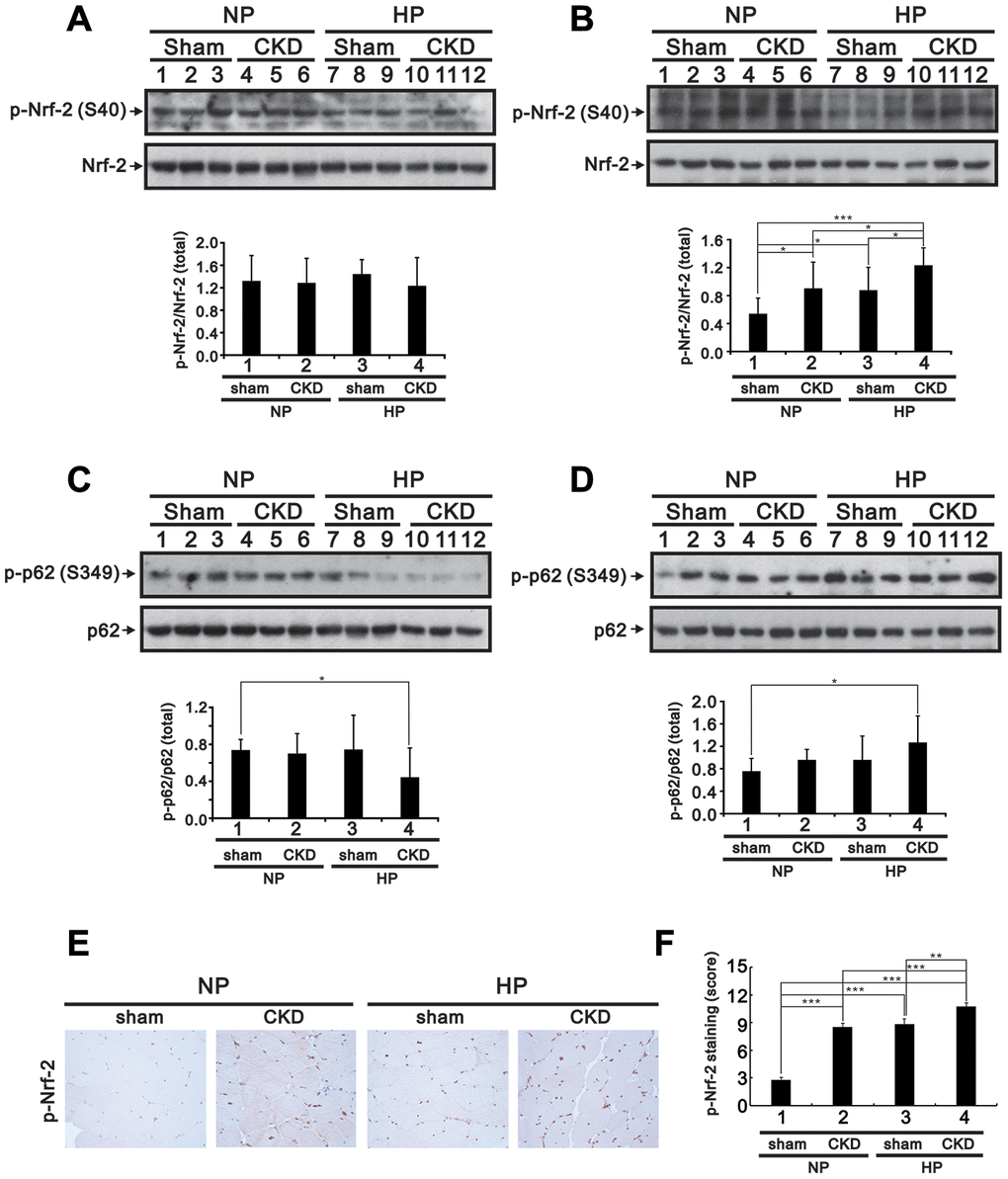 High-Pi diet alters Nrf2 and p62 expression in GA muscle from sham-operated and CKD mice. Eight-week-old mice underwent either a sham operation or 5/6 nephrectomy (CKD), after which they were fed a normal Pi (NP) or high-Pi (HP) diet for 20 weeks. Cytosolic (A and C) and nuclear (B and D) fractions were extracted from GA muscle samples and probed for Nrf2 and p-Nrf2 (A and B) and for p62 and p-p62 (C and D). Levels of these proteins were quantified by computer-assisted densitometric analysis. (E) Representative images of p-Nrf2 immunohistochemistry in GA muscle sections. (F) Semiquantitative IHC scoring from images like those shown in (E). Data are presented as means ± SEM. *P 