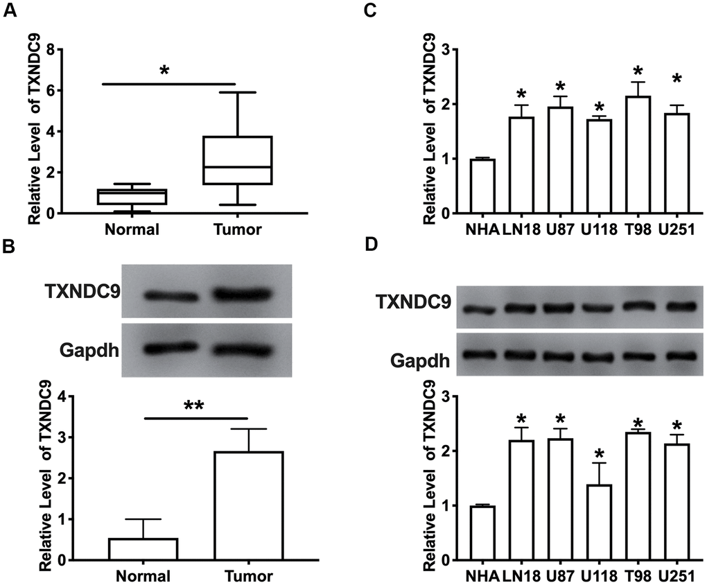 TXNDC9 was upregulated in glioma tissues and cells. (A) The mRNA level of TXNDC9 in tumor and normal samples was detected by RT-PCR. n=40, *PB) The protein level of TXNDC9 in tumor and normal samples was detected. n=6, *PC) The mRNA level of TXNDC9 in different glioma cell lines (LN18, U87, U118, T98, U251) were detected by RT-PCR. NHA cell was indicated as a control. n= 6, *PD) The protein level of TXNDC9 in different glioma cell lines. n= 4, *P