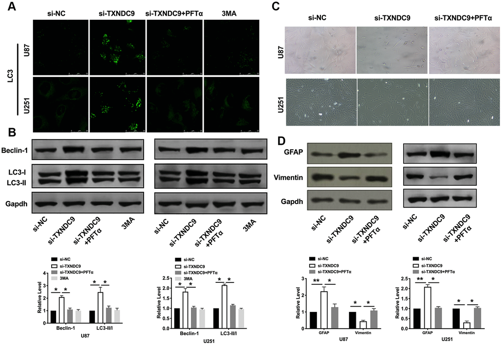 TXNDC9 regulated glioma autophagy and differentiation via controlling p53. (A) The level of LC3 and localization in U87 and U251 cells after si-TXNDC9/si-NC transfection, PFTα, and 3MA (5 mM) treatment. Representative immunofluorescence images were shown. (B) The protein level of Beclin-1 and LC3-I/II was detected in U87 and U251cells; Gapdh was indicated as a loading control. n= 6, *PC) U87 and U251 cell morphology were scanned after si-TXNDC9/si-NC transfection and PFTα treatment. (D) The protein level of vimentin and GFAP were measured in U87 and U251 cells, Gapdh was indicated as a loading control. n= 6, *PP