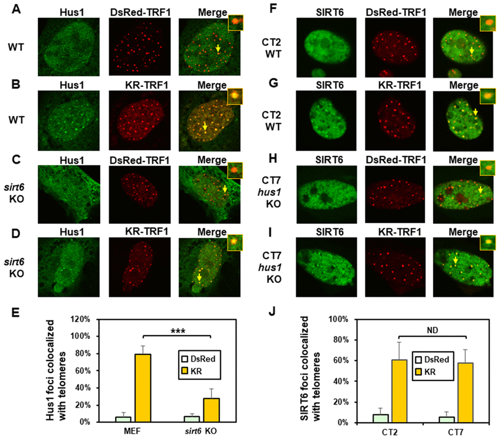 The formation of Hus1 foci induced at oxidatively damaged telomeres is partially dependent on SIRT6. (A and C), GFP-Hus1 does not form foci at sites with DsRed-TRF1 in undamaged control MEF and sirt6 KO MEF cells, respectively. (B and D), Damage response of GFP-Hus1 to the sites of KR-TRF1 after light activation in control and sirt6 KO MEF cells, respectively. GFP-hHus1 foci are significantly reduced at the sites of KR-TRF1 in sirt6 KO cells. (E), Analyses of about 20 cells in each (A–D) group indicated that approximately 80% of GFP-Hus1 foci colocalized with telomeres in control cells, in contrast, only 30% of GFP-Hus1 foci colocalized with telomeres in sirt6 KO cells. (F–J), GFP-hSIRT6 foci formation at telomeres in control CT2 and Hus1 KO CT7 MEF cells. Experiments were performed similarly to (A–E) except using GFP-hSIRT6 and different cells. After ROS induction by activating the KR protein, about 60% of GFP-SIRT6 foci are colocalized with KR-TRF1 in both CT2 and CT7 cells (J).