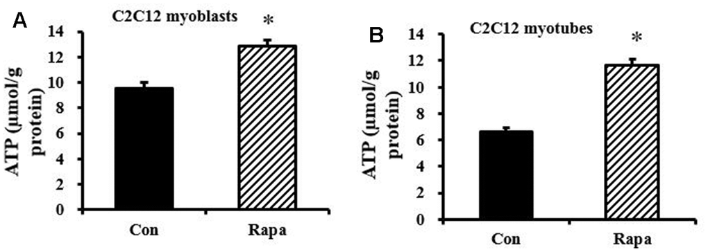 Effect of rapamycin on ATP concentration in C2C12 myoblasts and myotubes. (A) ATP concentration of C2C12 myoblasts, which were cultured for 48 h, then treated by rapamycin (100 nM) for 24 h. (B) ATP concentration of C2C12 myotubes, which were cultured for 6 d, then treated by rapamycin (100 nM) for 24 h. *, P t test.