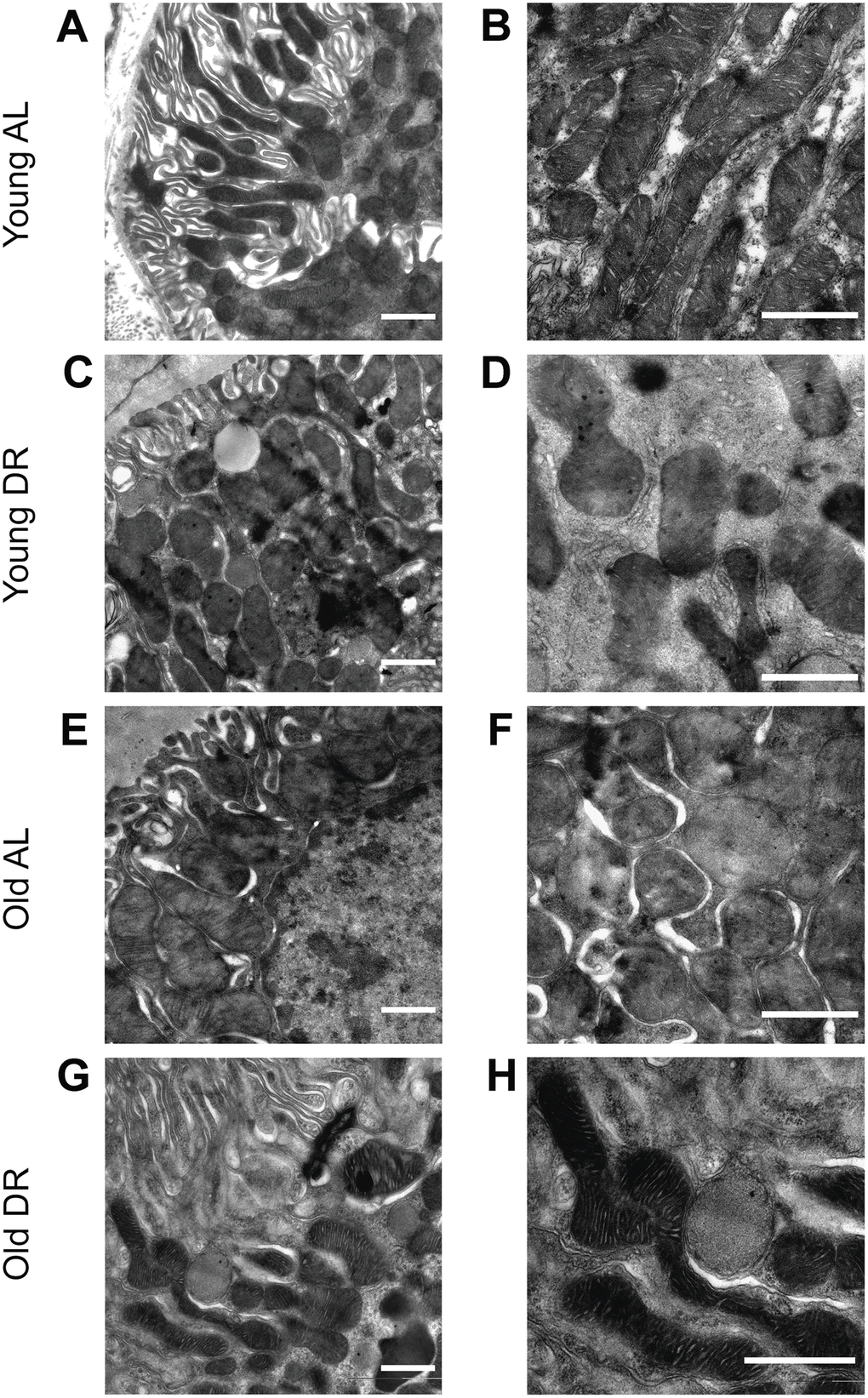 Ultrastructure of mitochondria of renal tubular cells in the intact kidney of young (A, B) and old (E, F) rats and those after DR (C, D and G, H, correspondingly). Renal tubular cells in young rats contain mitochondria in the orthodox configuration, while mitochondria in the old kidney demonstrate slight swelling of intercristae space and matrix. Tubular epithelium of kidney after DR exposure demonstrates noticeable condensation of the mitochondrial matrix in both young (C, D) and old (G, H) rats. Scale bar, 1 μm. For young AL rats n=5, for young DR rats n=6, for old AL rats n=6, for old DR rats n=5. AL, ad libitum, DR, dietary restriction.