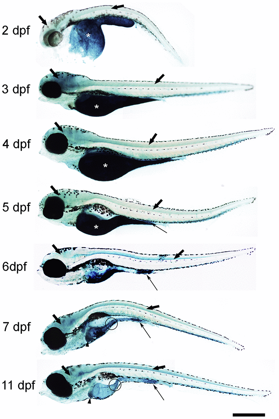 Photomicrographs of whole-mounted developing zebrafish showing the presence of SA–β–gal staining. Representative images of 2, 3, 4, 5, 6, 7 and 11 dpf zebrafish are shown. The asterisks indicate the presence of intense SA–β–gal staining in the yolk. Thin arrows indicate the presence of intense SA–β–gal staining in the caudal (cloacal) end of the intestine. Thick black arrows indicate the presence of SA–β–gal staining in the brain. Thick empty arrows indicate the presence of SA–β–gal staining in the spinal cord. Arrowheads indicate the presence of SA–β–gal staining in the liver. Circles indicate the presence of SA–β–gal staining in the oesophagus. Scale bar: 200 μm. Images are a composition of different pictures taken under the microscope overlapped together and modified using the same parameters.